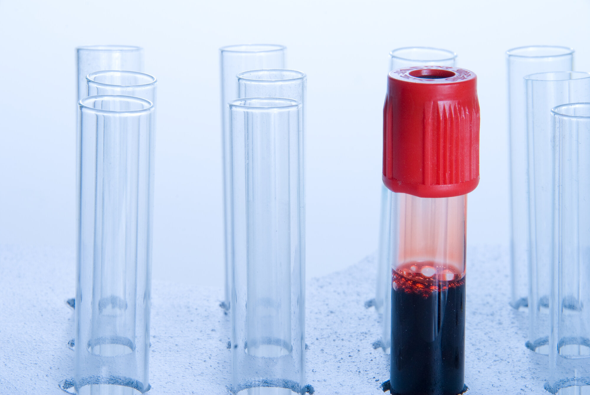 Blod, blodprøve Bildet viser et blodprøveglass fylt med blod.