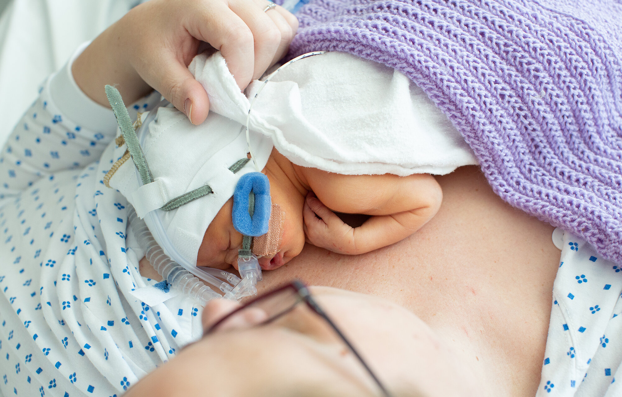 For tidlig født Bildet viser et for tidlig født barn som hviler på mors bryst.