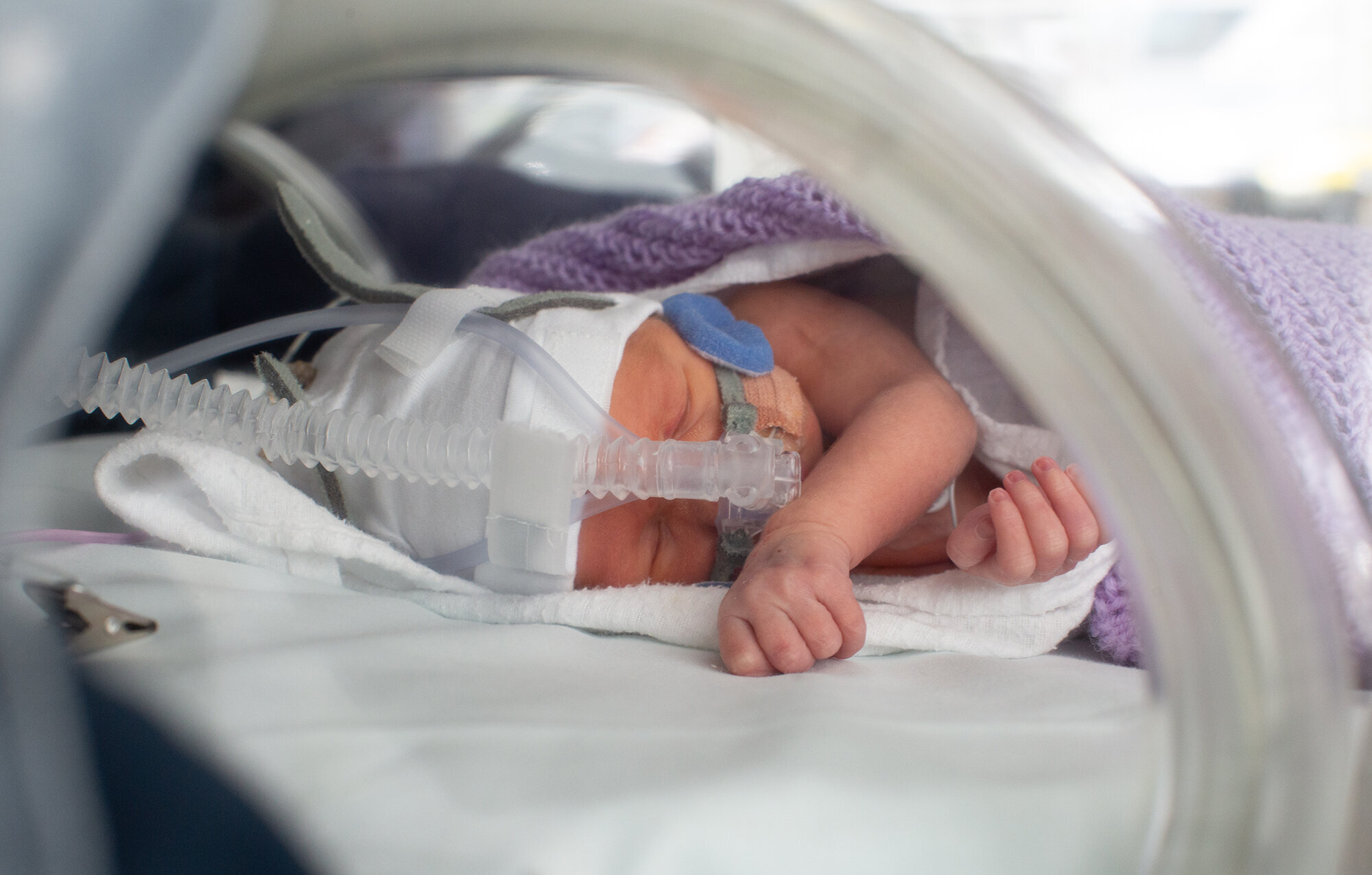 Nyfødt i kuvøse Bildet viser et for tidlig født barn som ligger i kuvøse.