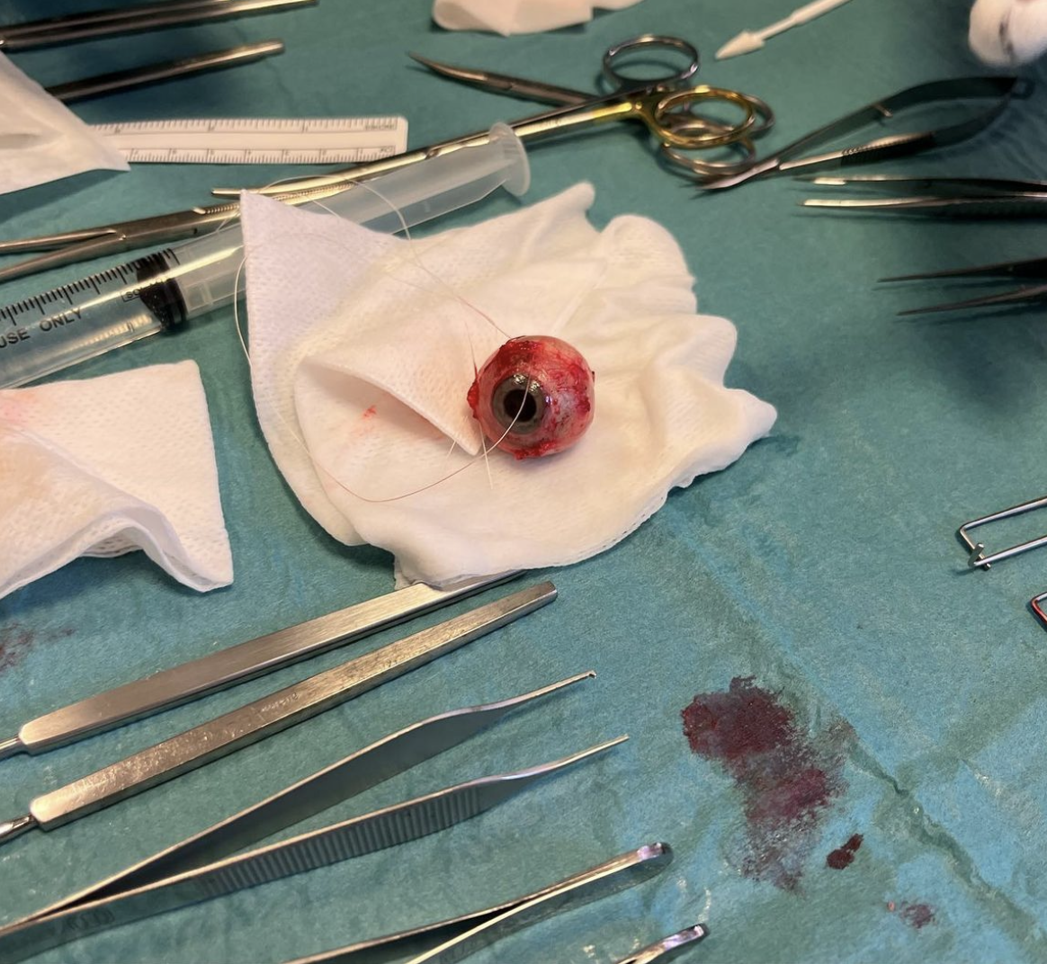 Øye Bildet viser et øye.