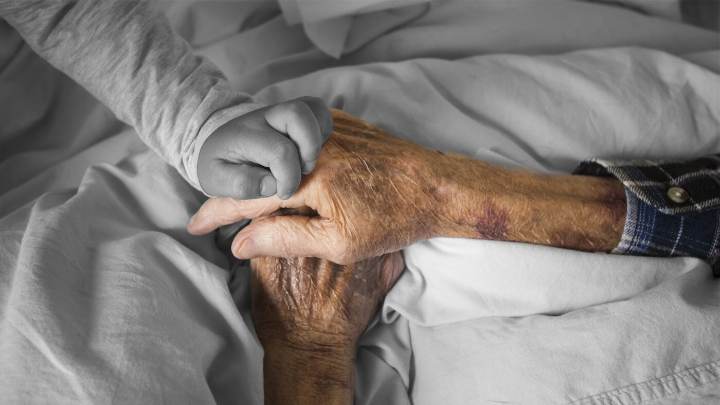 Eldre pasient med blåmerker på armene. Bildet viser en eldre pasient med blåmerker på armene.