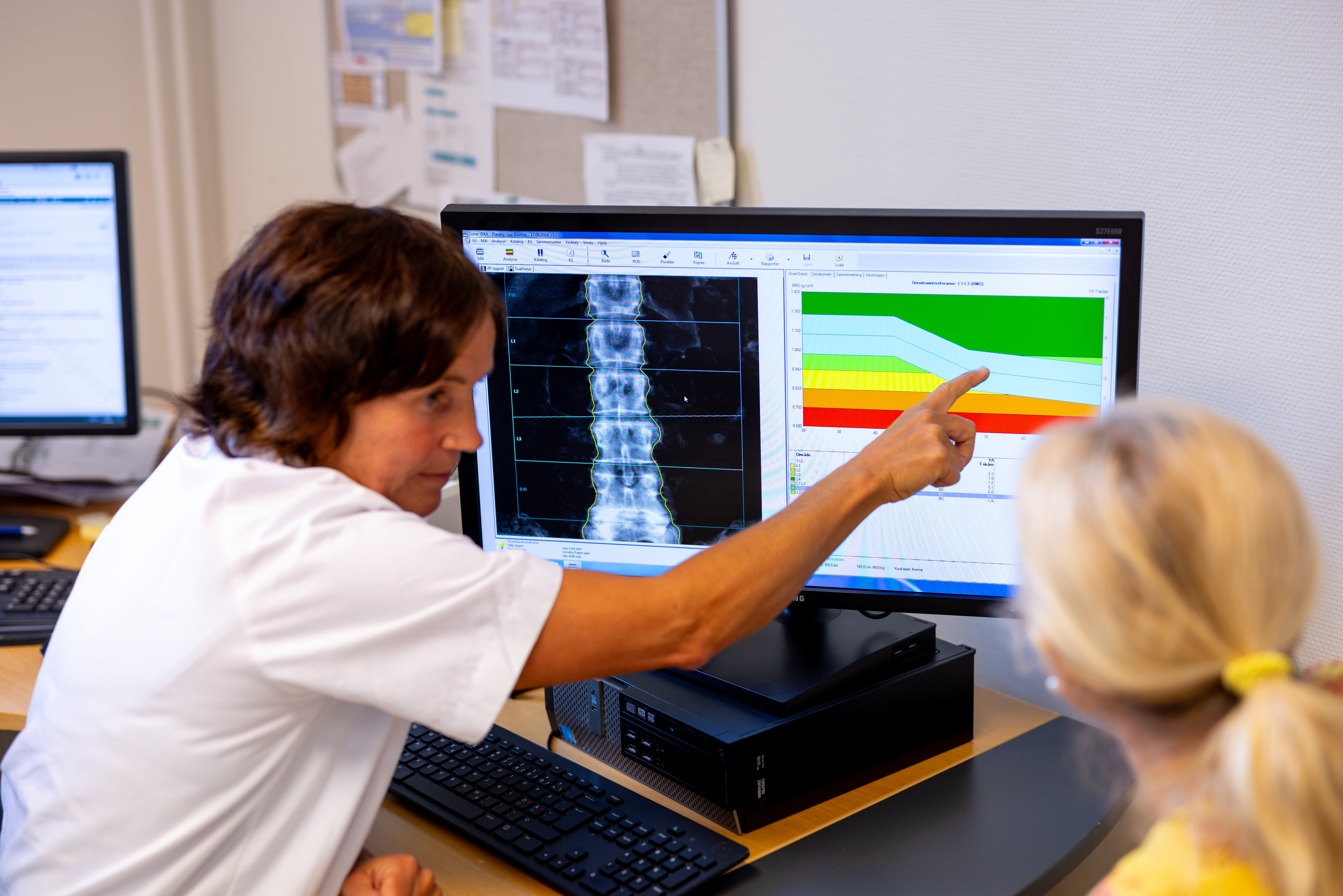 Merete Finjarn med pasient som forklarer DXA-bildet bildet viser Merete Finjarn med pasient som forklarer DXA-bildet