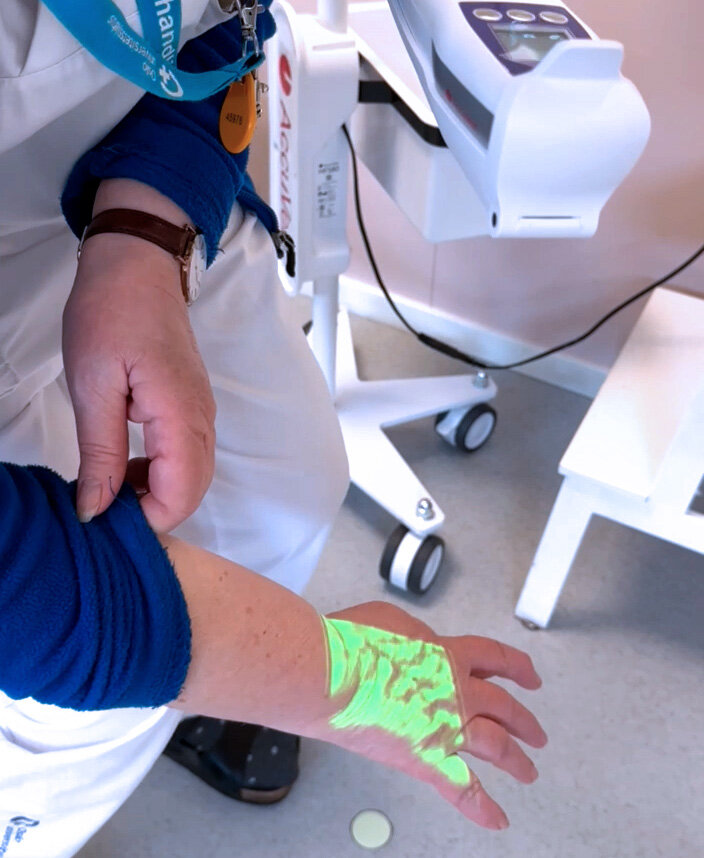 Bilde viser en blodåreskanner