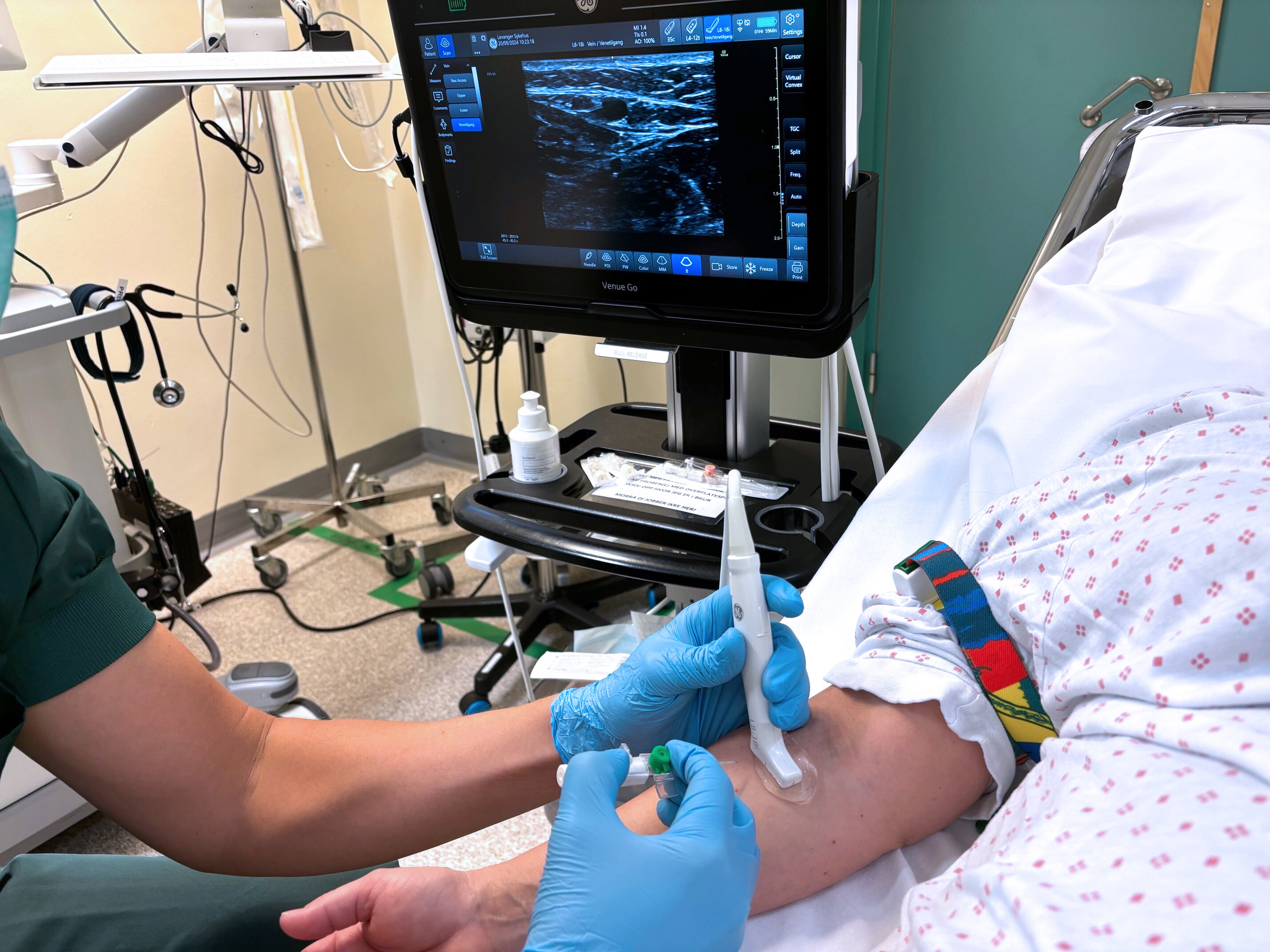 ultrasound-guided PVC The photo shows a nurse using ultrasound to locate a vein before catheterisation