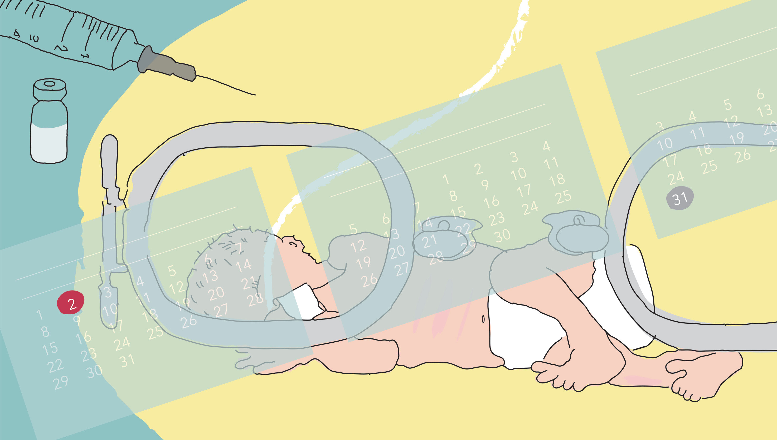 Premature Bildet viser en tegnet illustrasjon av en baby som ligger i en kuvøse.