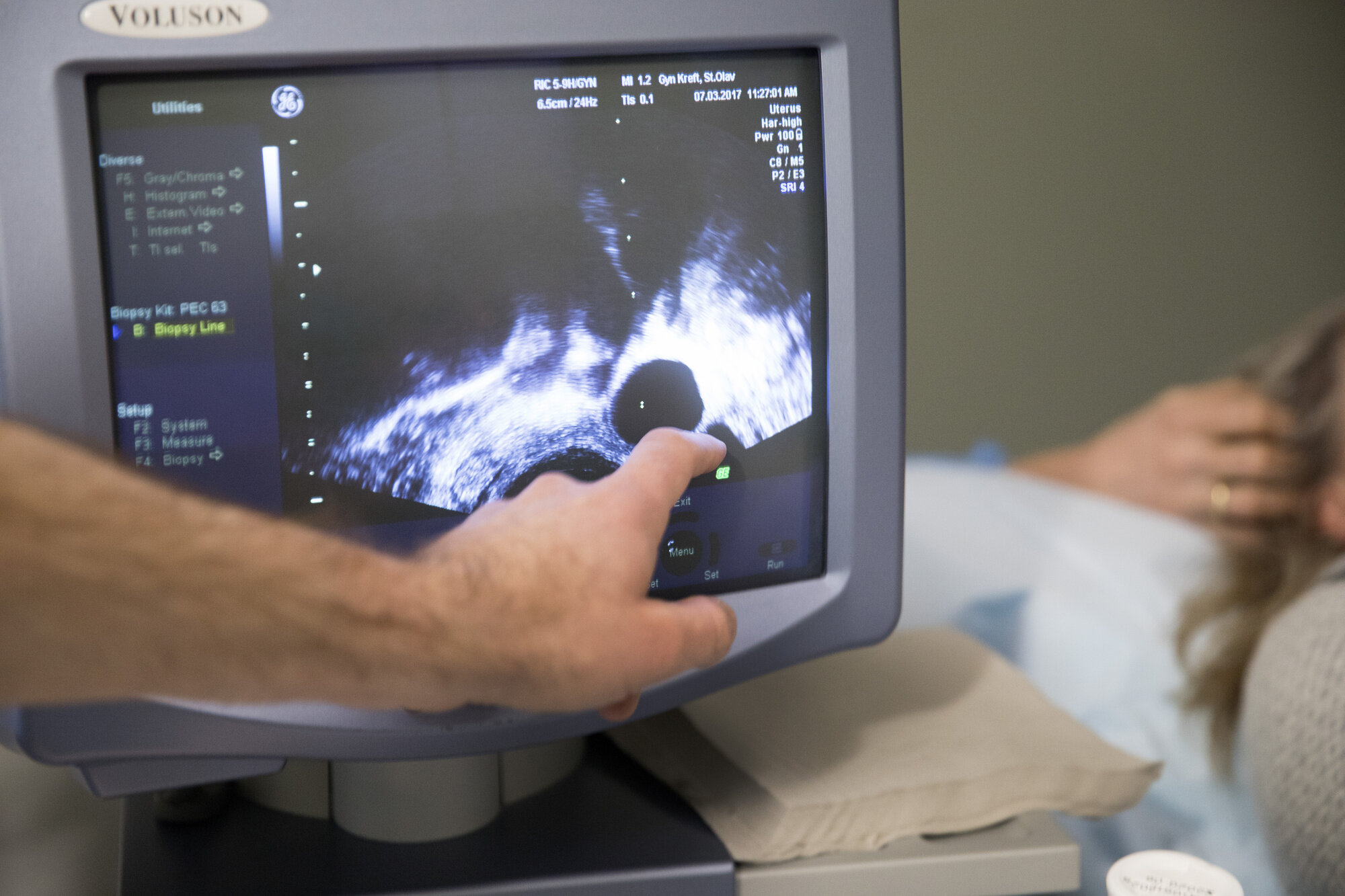 Bildet viser en ultralyd
