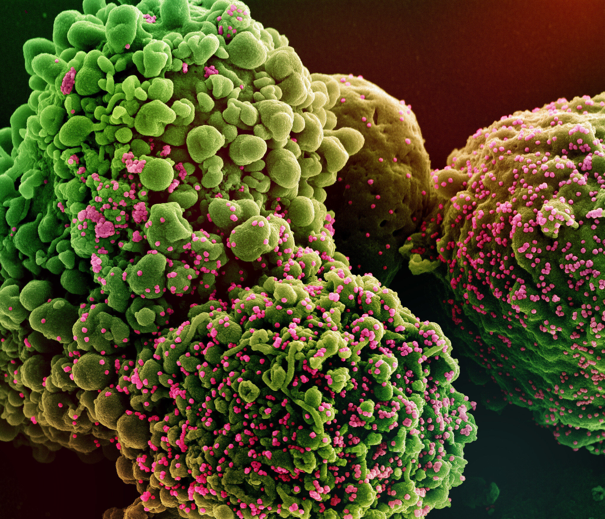 bilde av omikronviruset