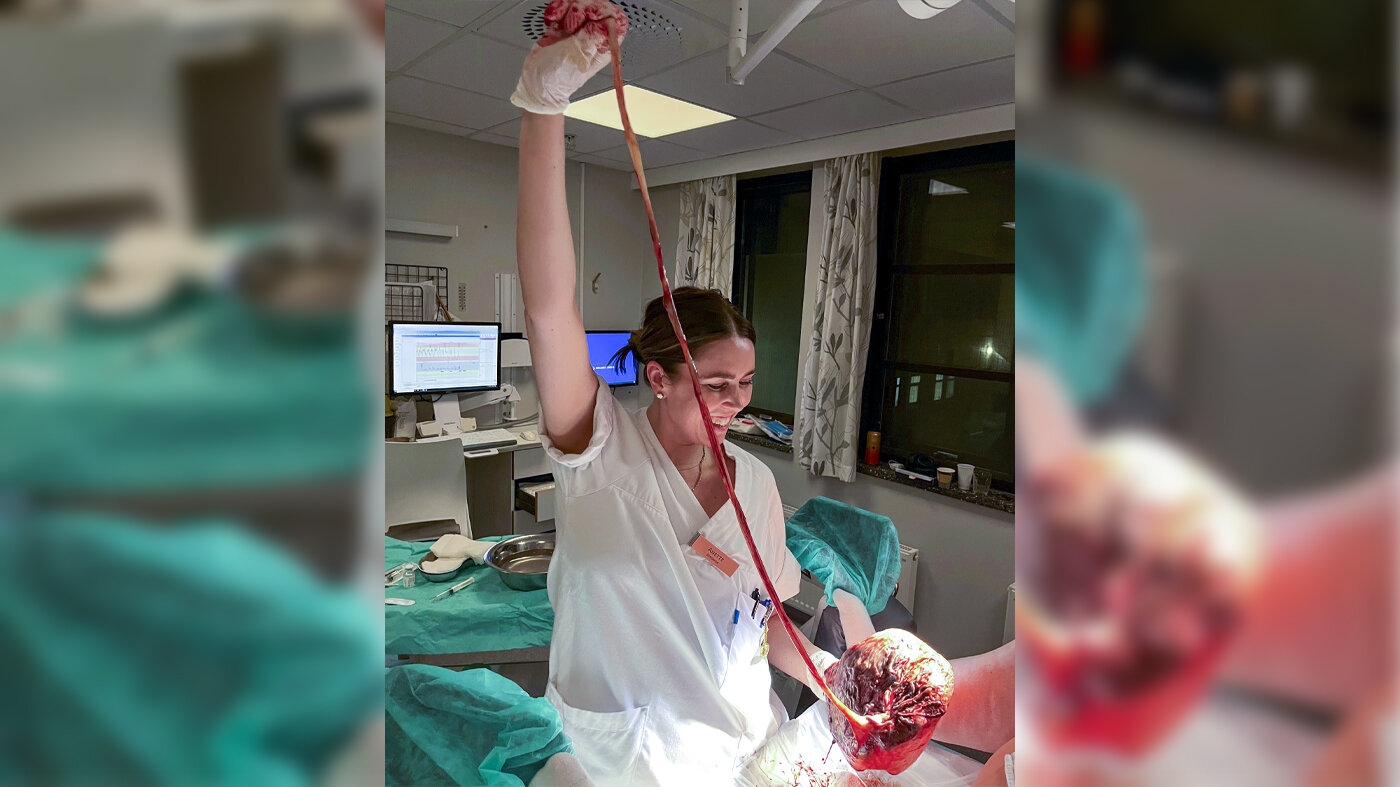 Anette Borgen Fjellhøy Bildet viser Anette Borgen Fjellhøy som holder opp navlesnor.