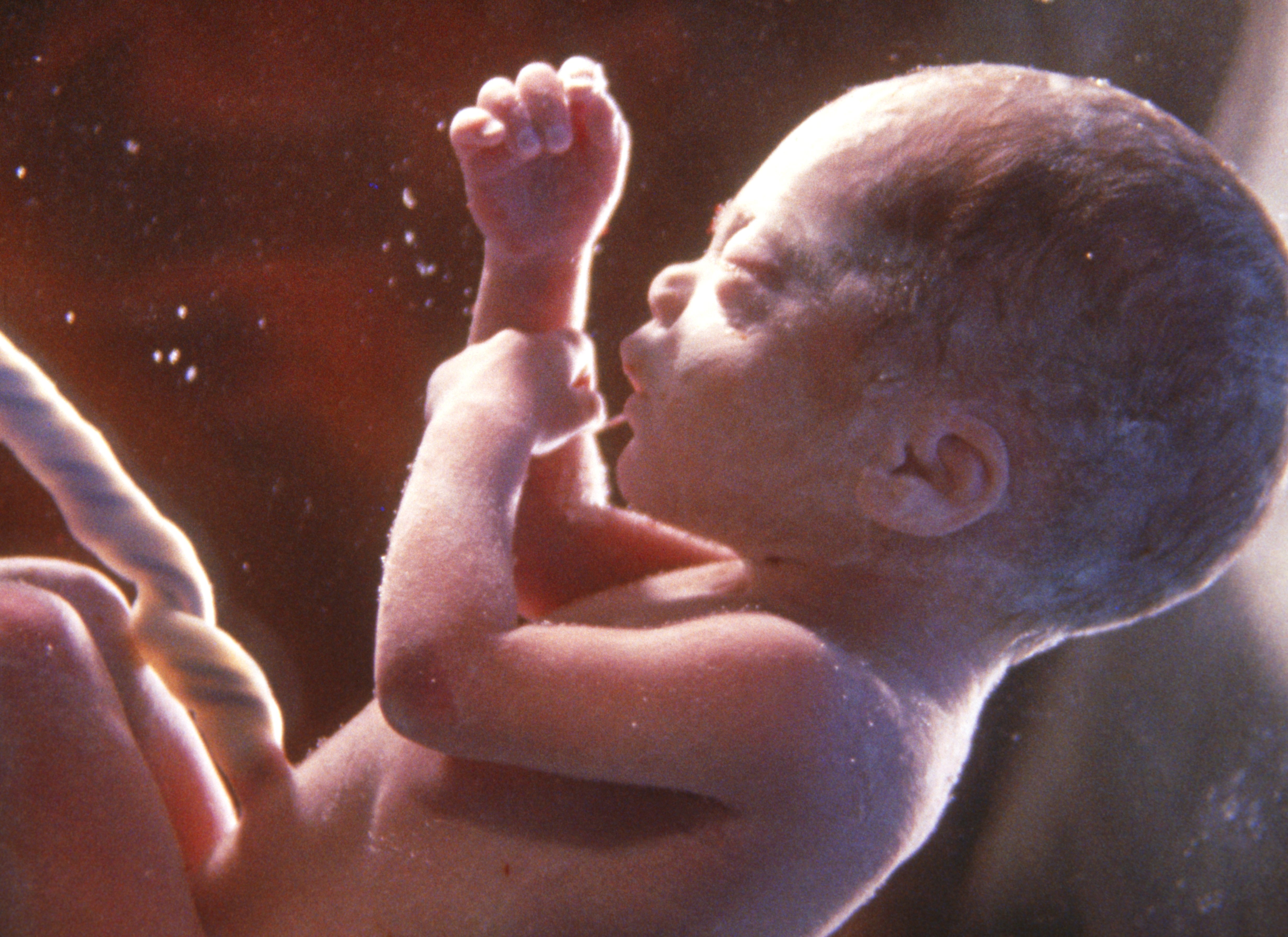 Foster, navlenor Bildet viser et foster med navlesnor.