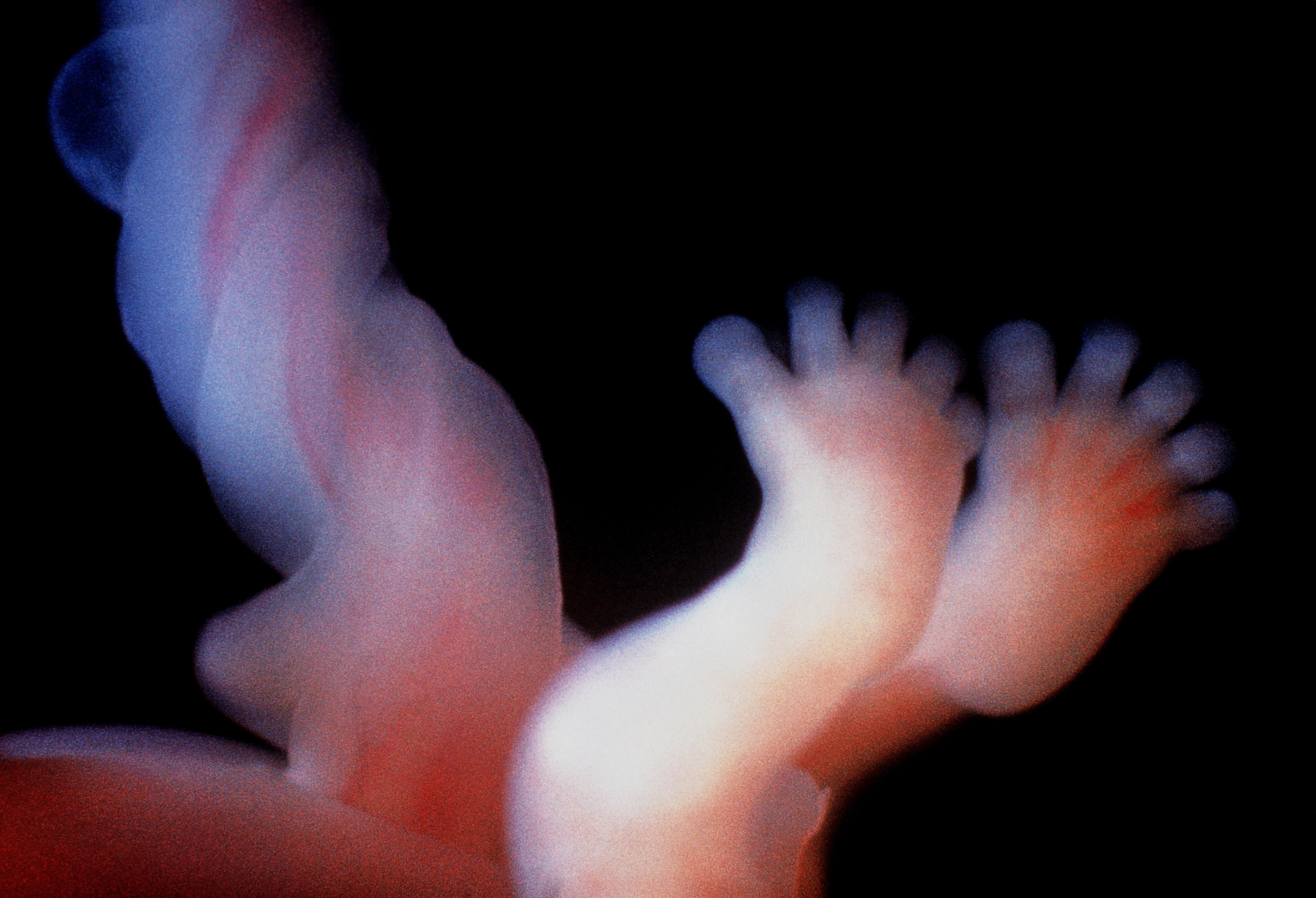 Foster, navlesnor Bildet viser foster med navlesnor.