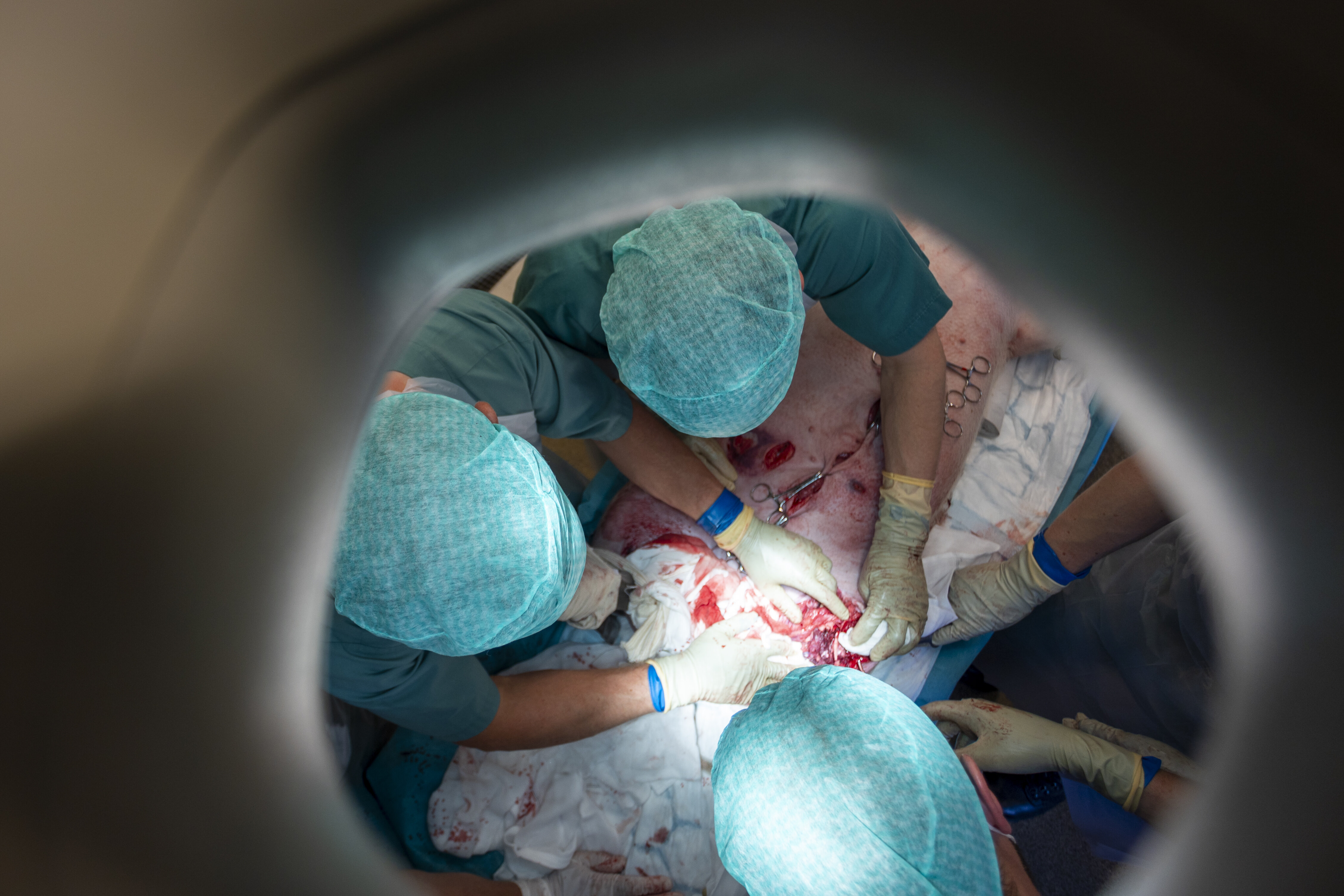 Forsvarets sanitet, krigskirurgi Bildet viser et operasjonsteam sett ovenfra.