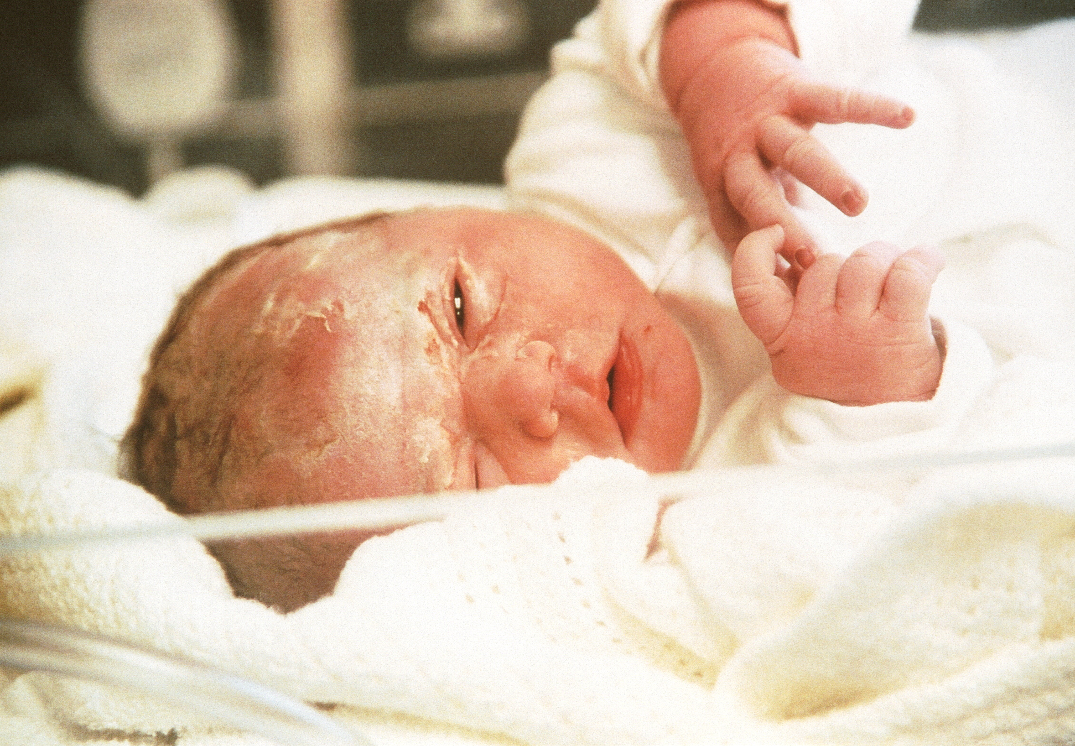 Bildet viser en nyfødt baby.