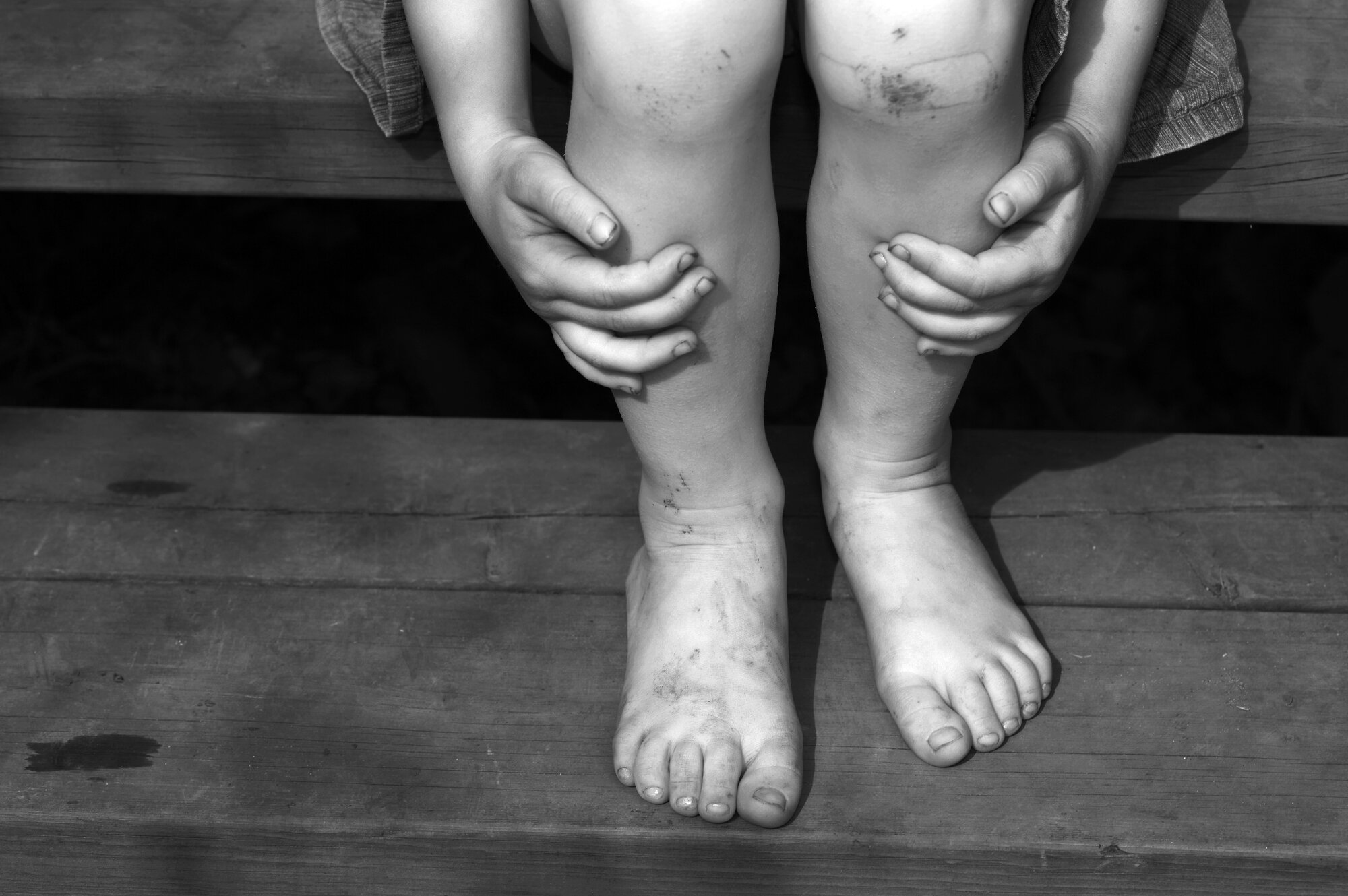 Illustrasjonsbilde av barn som er skadet. Illustrasjonsbilde av barn som er skadet.