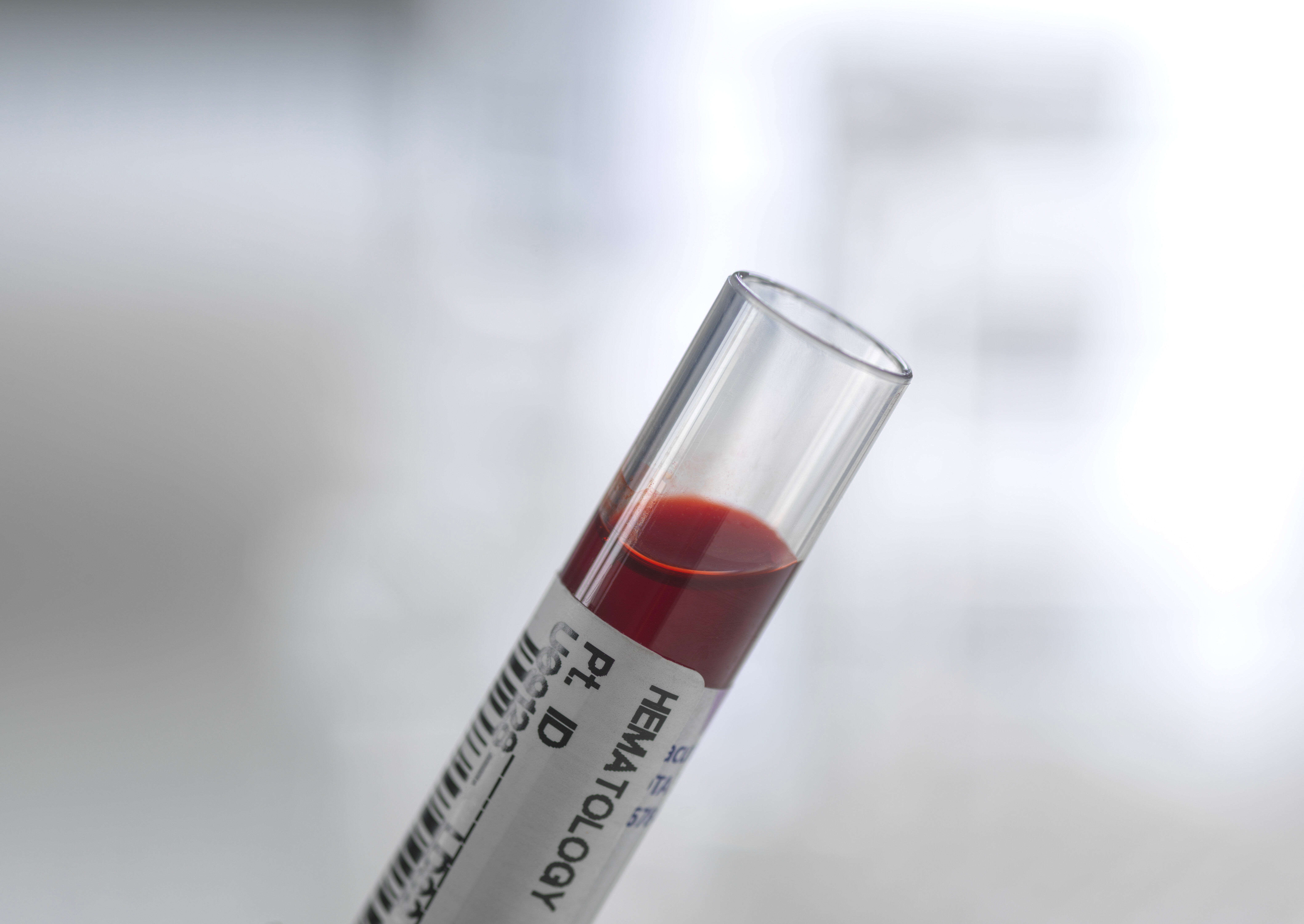 Blodprøve, blodprøveglass Bildet viser et blodprøveglass med blod i.