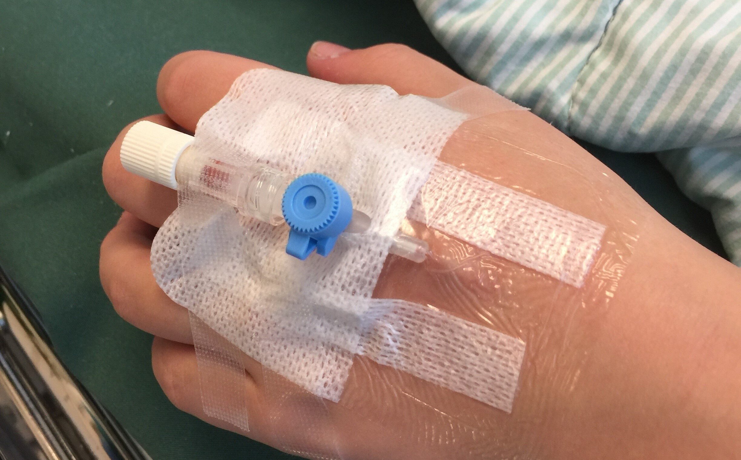 Bildet viser et perifert venekateter på en arm