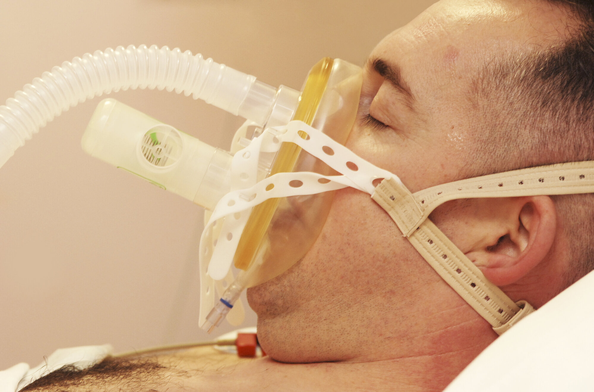 Mann med CPAP-maske Bildet viser mann som ligger på CPAP