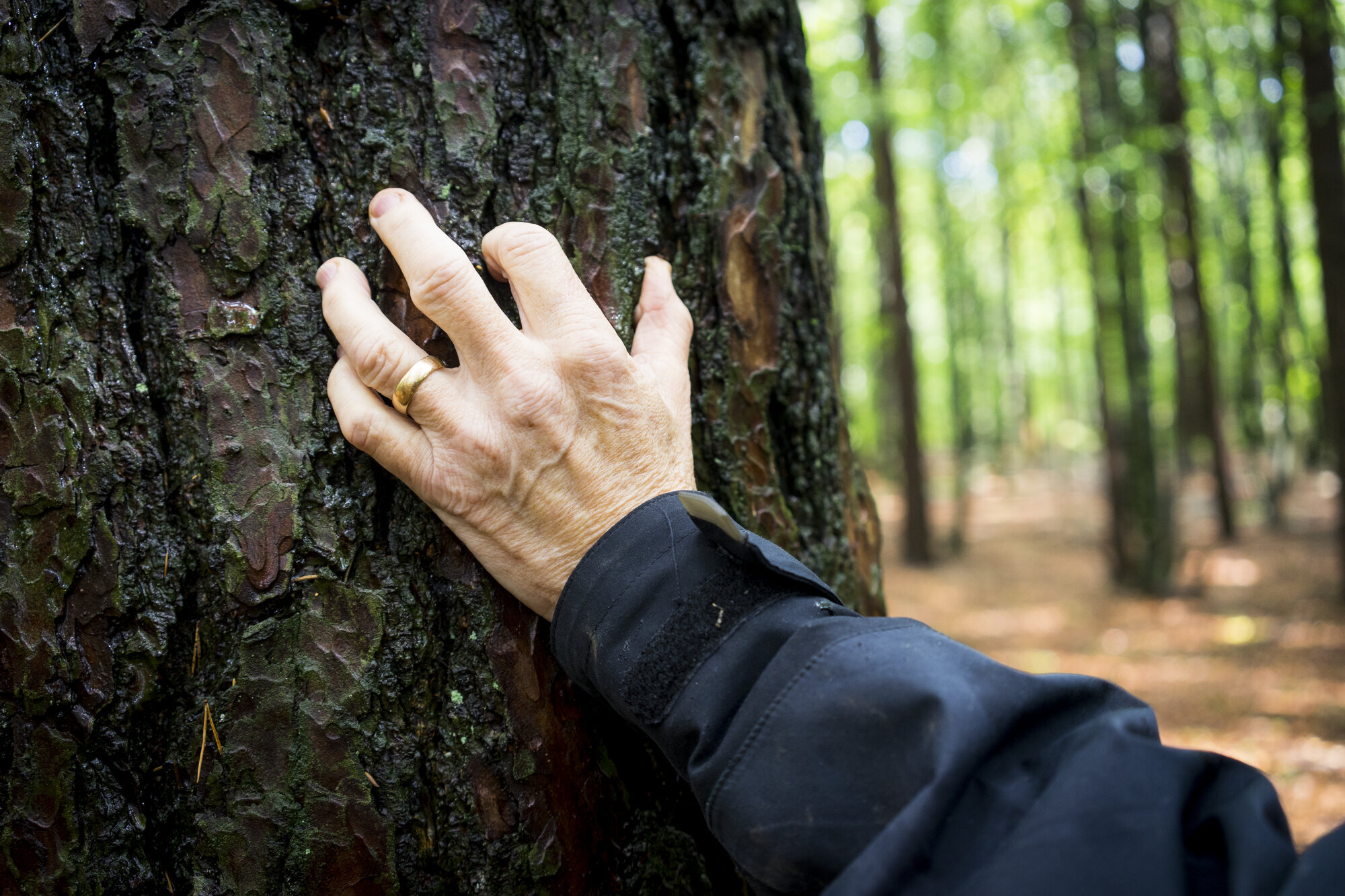 Hånda til Anna Bildet viser hånda til Anna