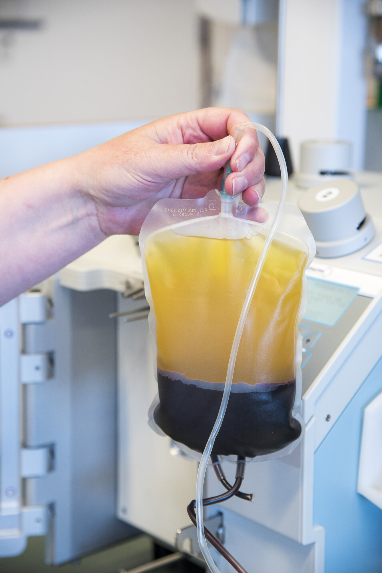 Plasma Bildet viser en blodpose med innhold som er sentrifugert, plasma øverst, buffy coat og så erytrocytter nederst.