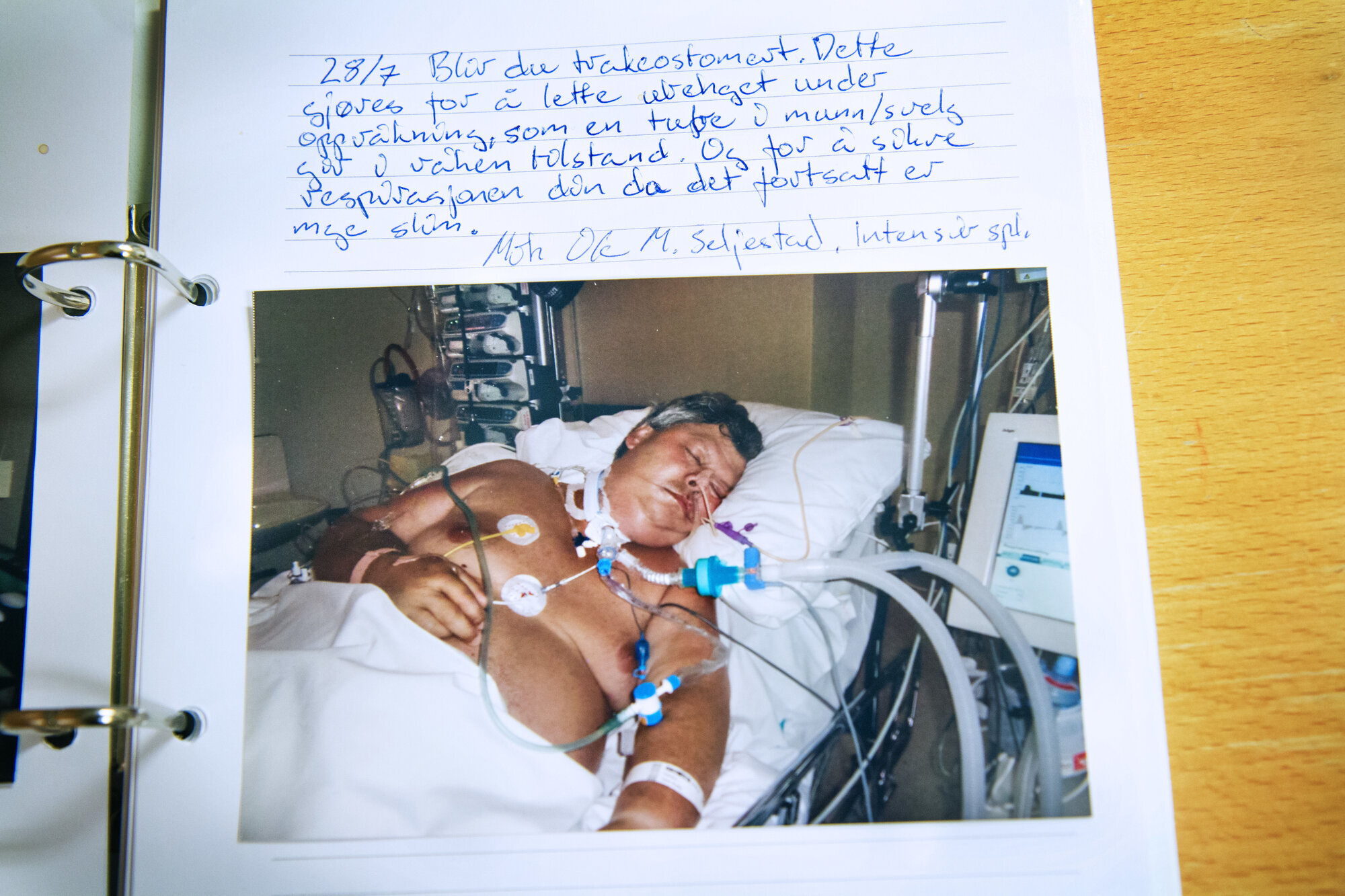 På respirator I koma på respirator