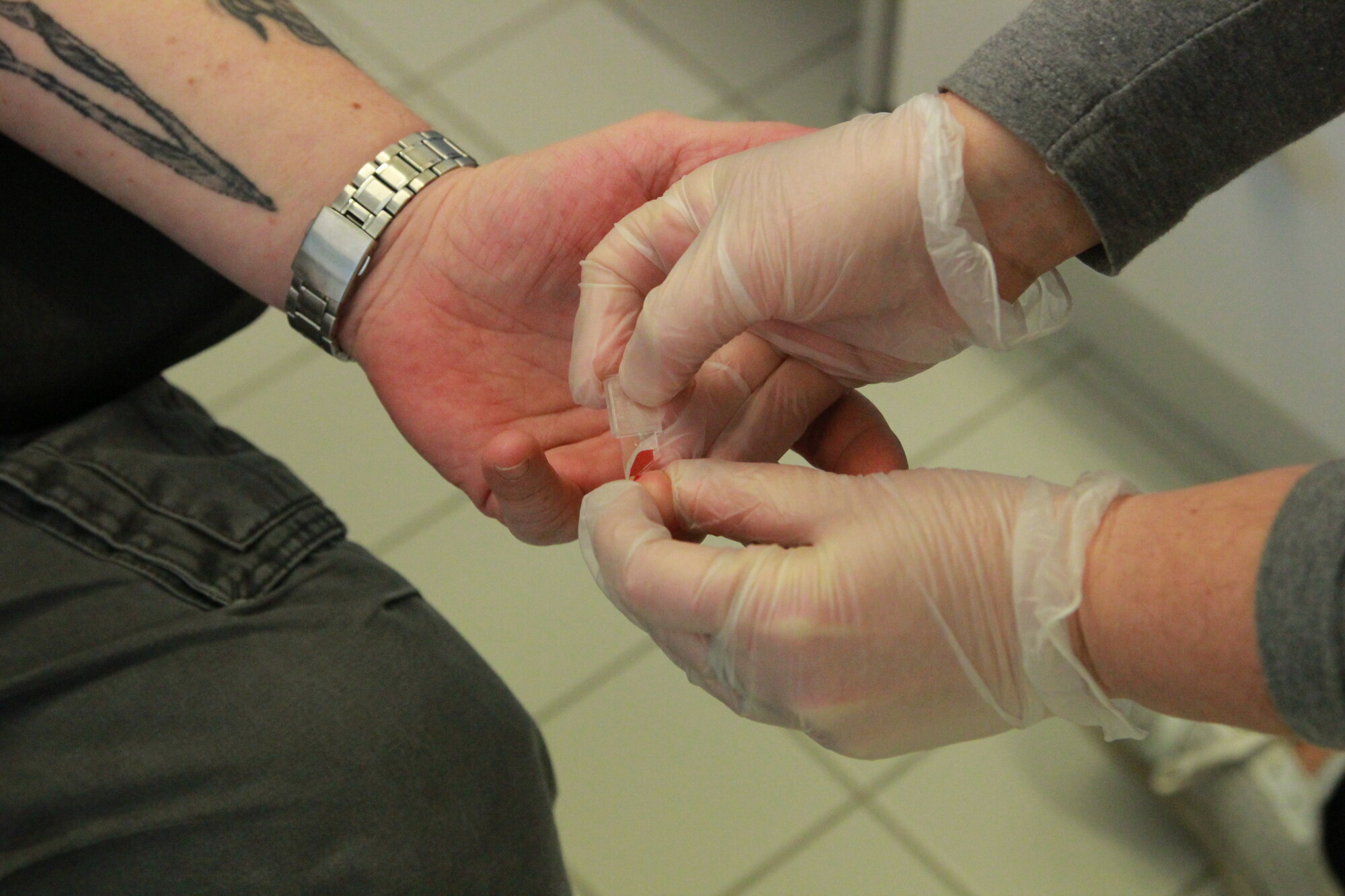 Blodsukkermåling Blodsukkermåling