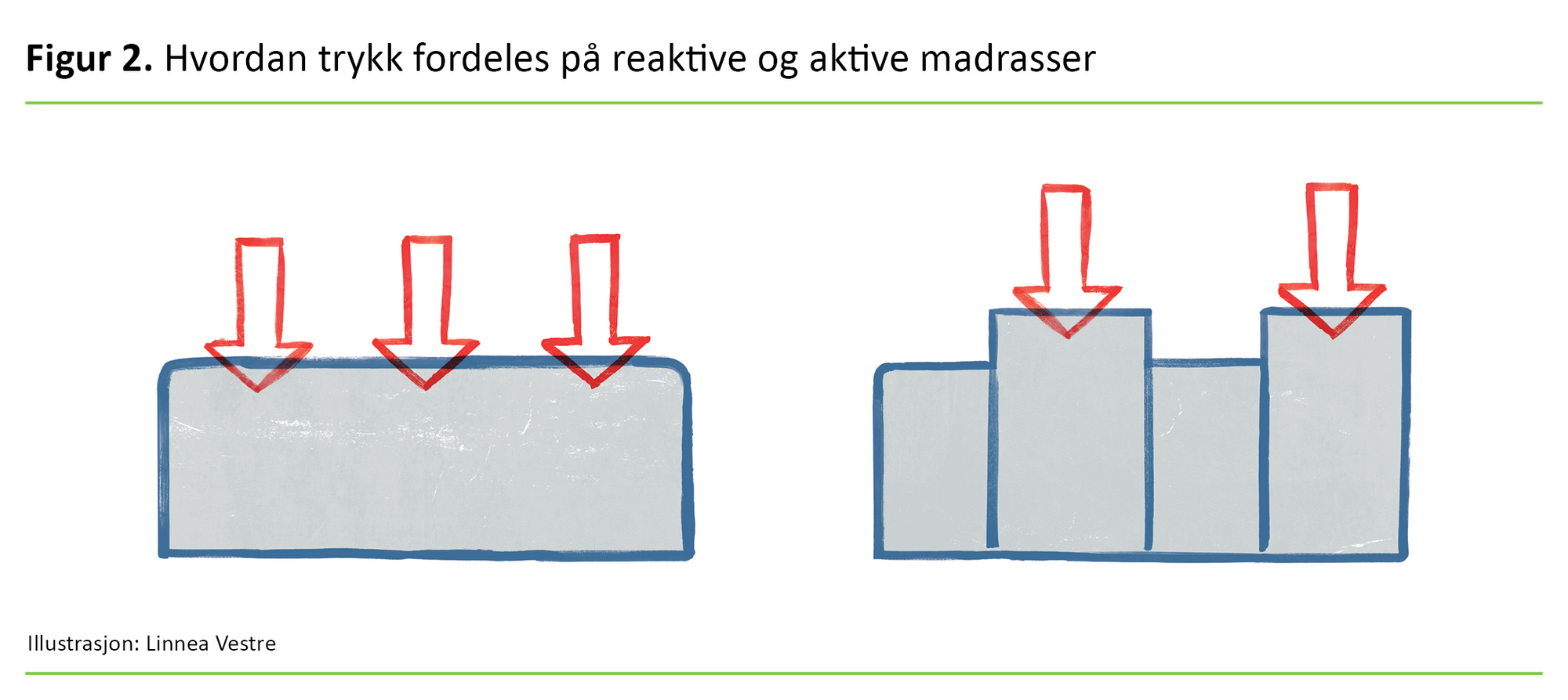 Figur 2 Figur 2. Hvordan trykk fordeles på reaktive og aktive madrasser