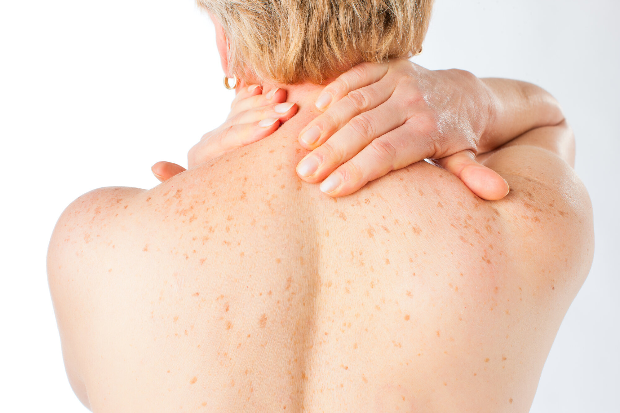 kvinne med skulderplager bildet viser kvinne med skulderplager