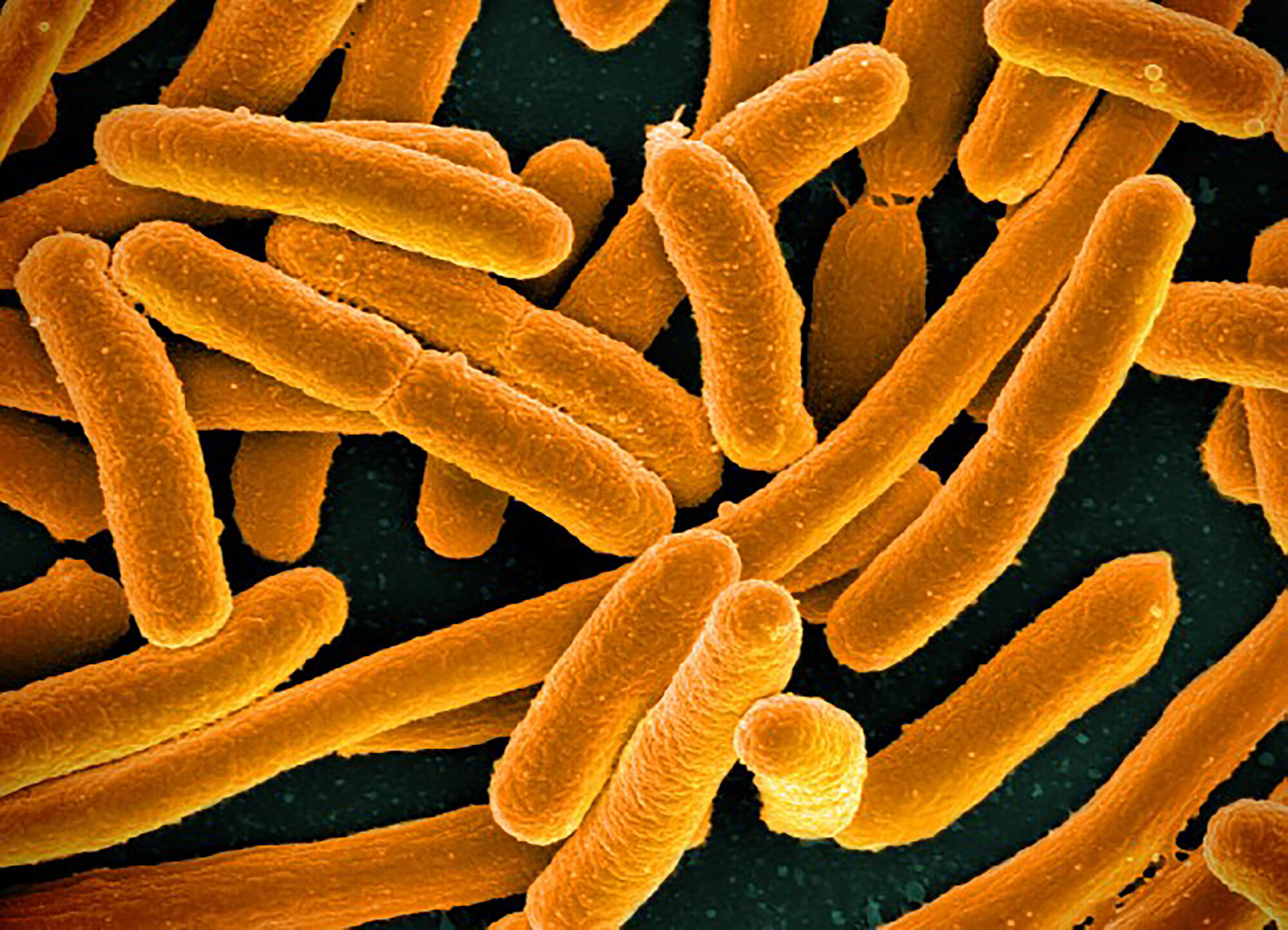 E. coli-bakterier Bildet viser E. coli-bakterier