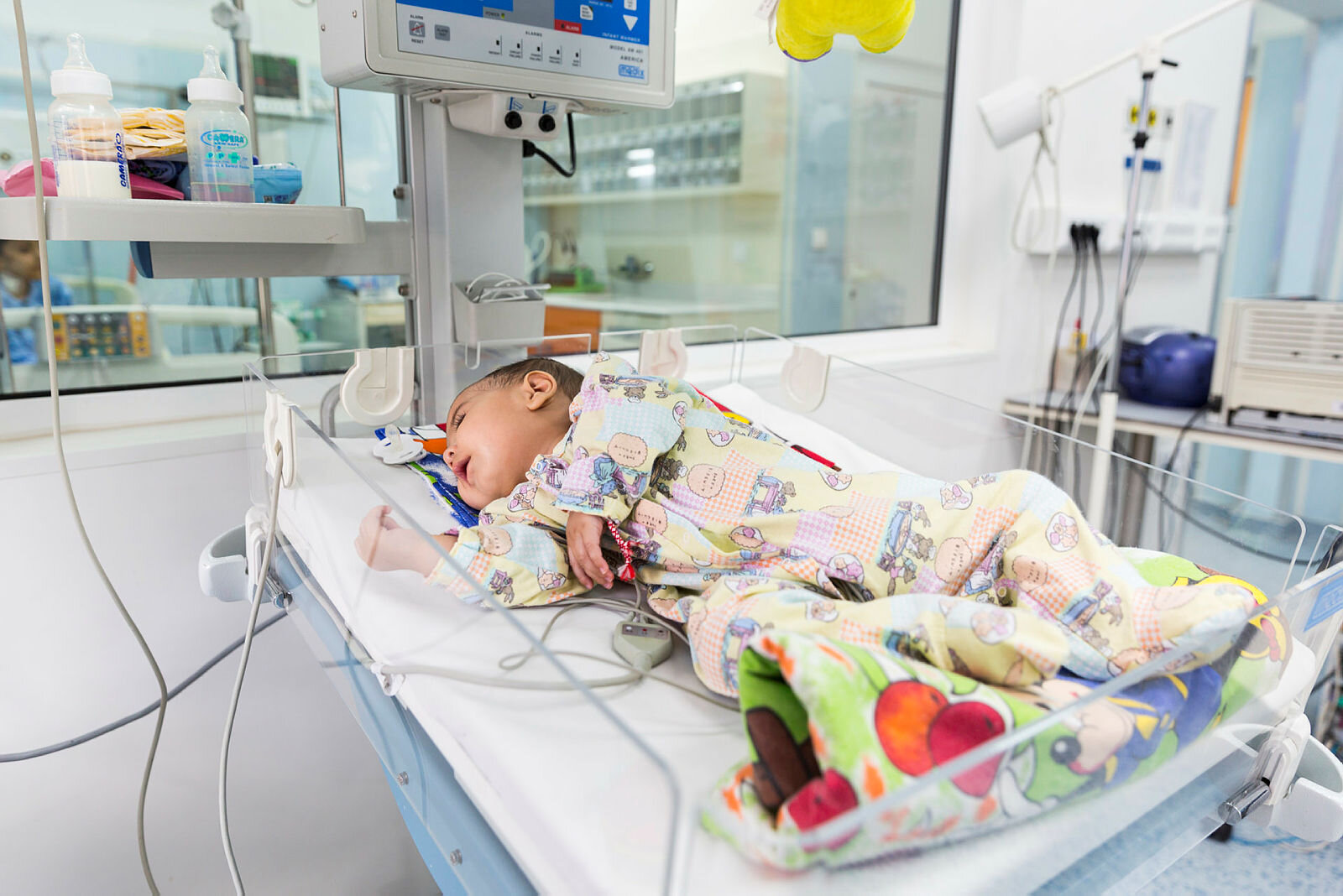 Baby på hjerteavdelingen Bildet viser en baby med hjertefeil som ligger i kuvøse på sykehus