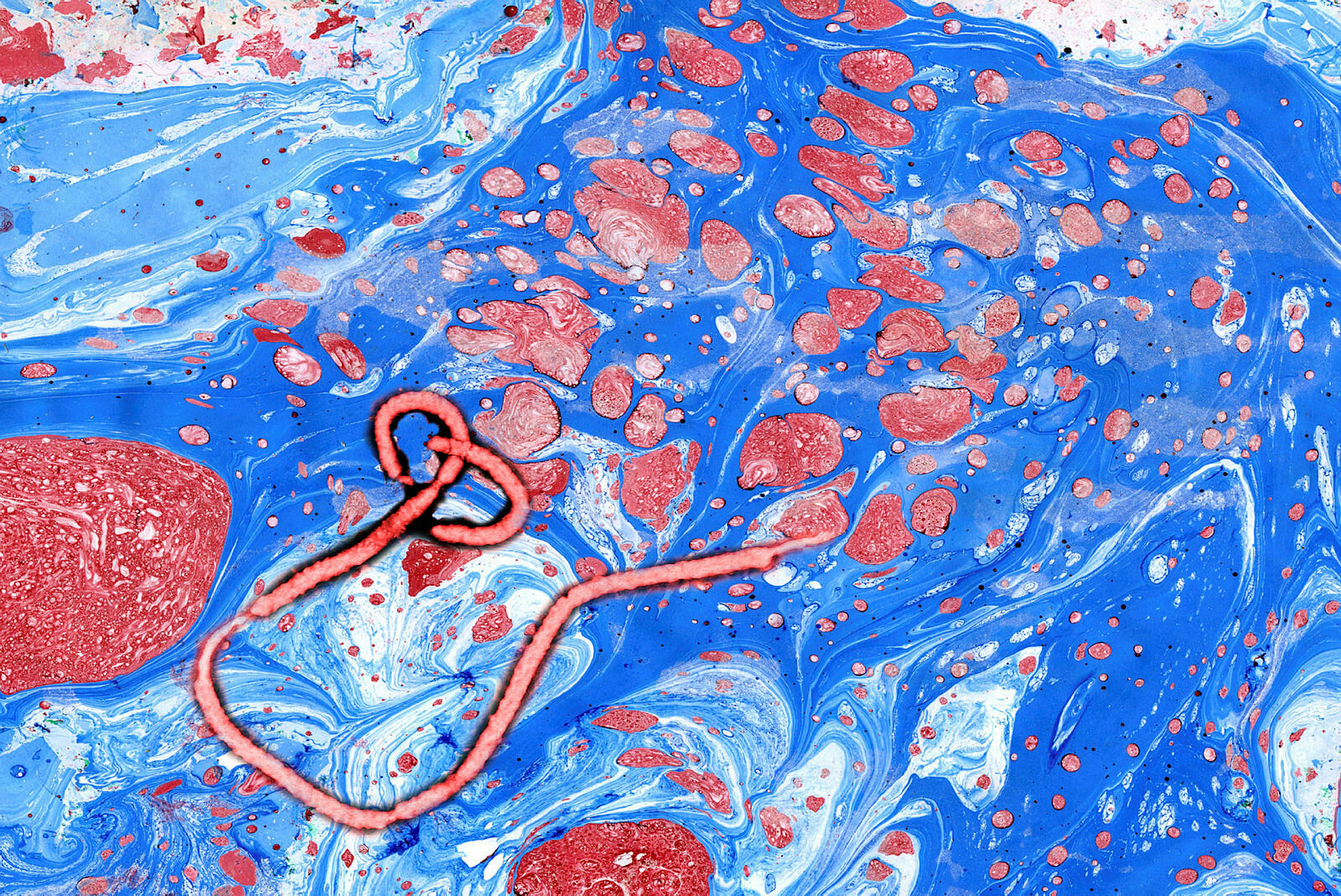 Ebolavirus Bildet viser et ebolavirus