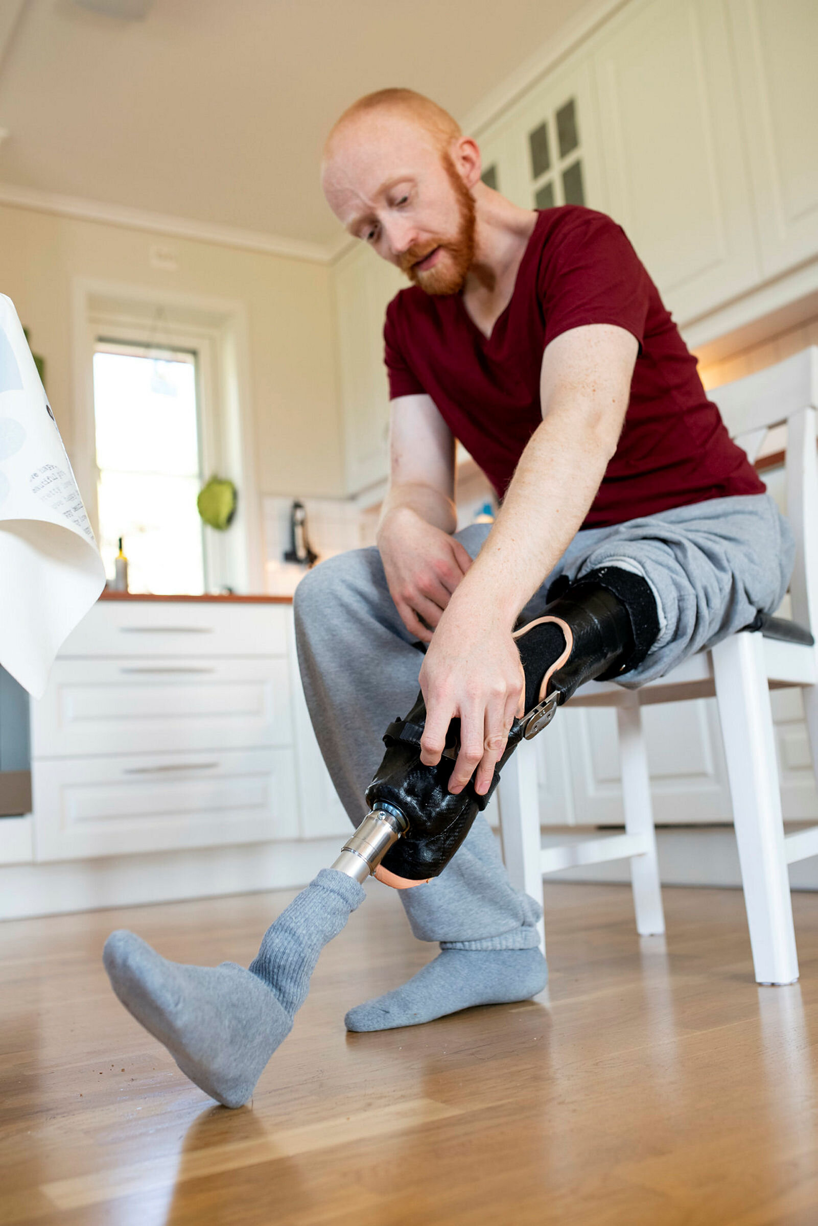 Kenneth Aas Bildet viser Kenneth Aas med protesen.