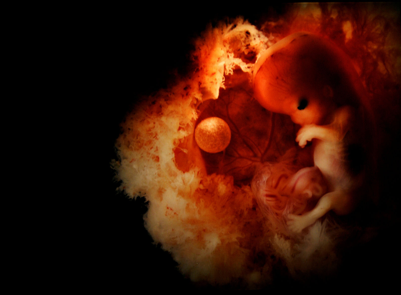 Bildet viser et foster