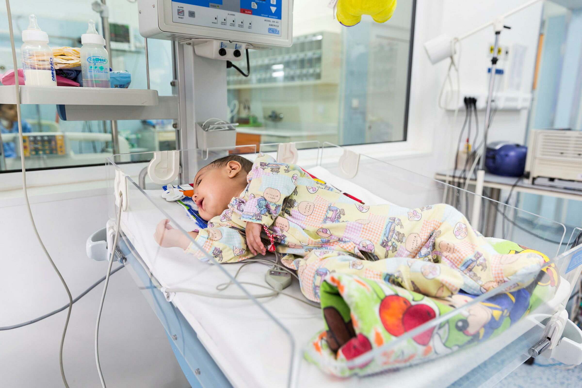 Bildet viser en baby med hjertefeil som ligger i kuvøse på sykehus