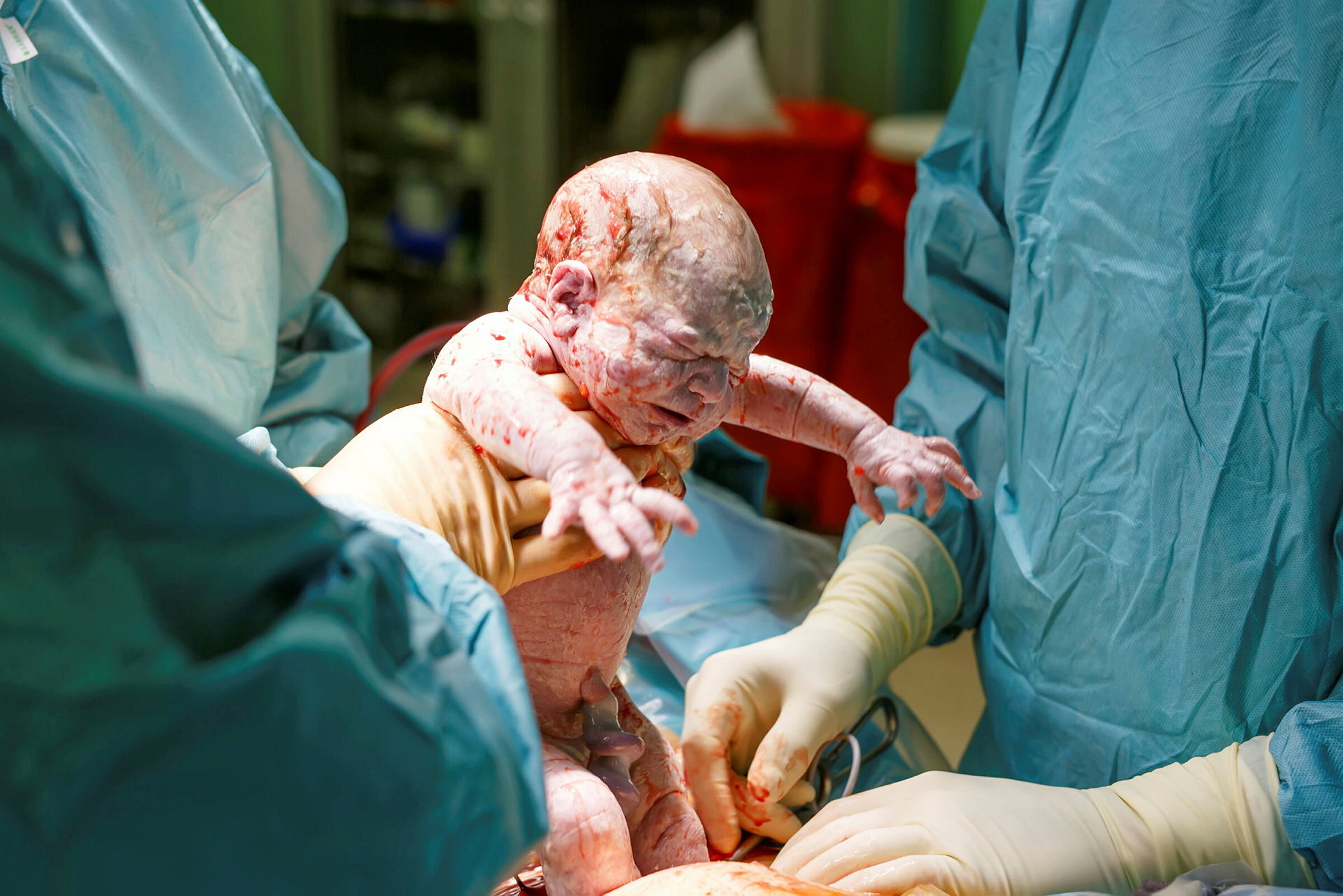 Bildet viser en nyfødt baby