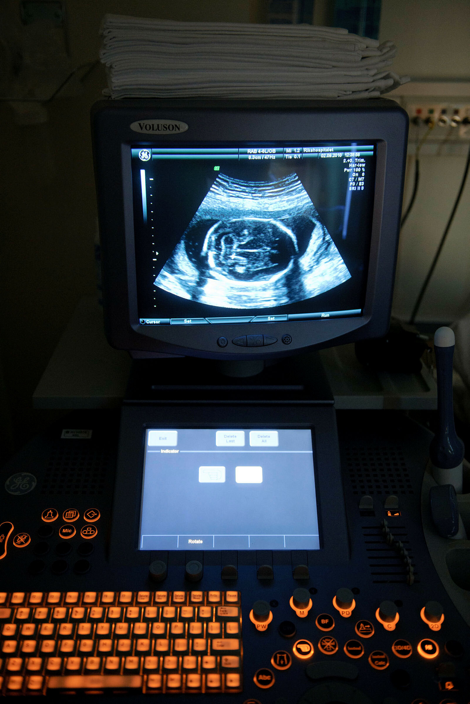 Ultralydundersøkelse.