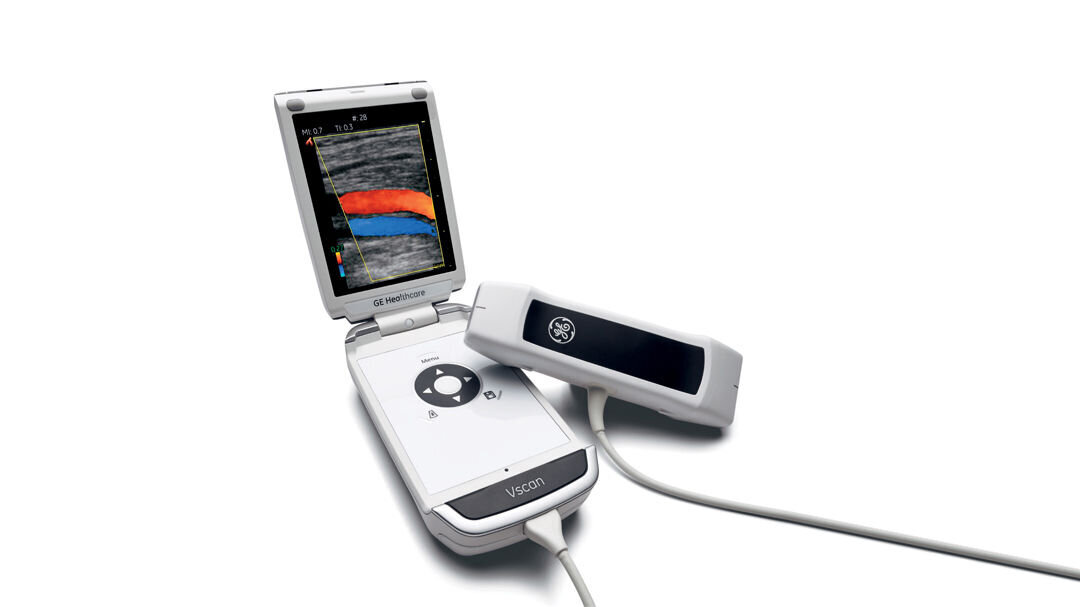 Håndholdt ultralydapparat Bildet viser et håndholdt ultralydapparat: GE Healthcare’s Vscan with Dual Probe