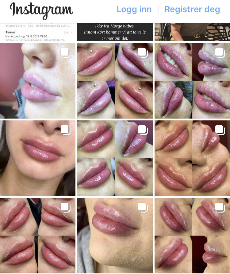 Instagramkontoen til Cliniica Bildet viser instagramkontoen til Cliniica