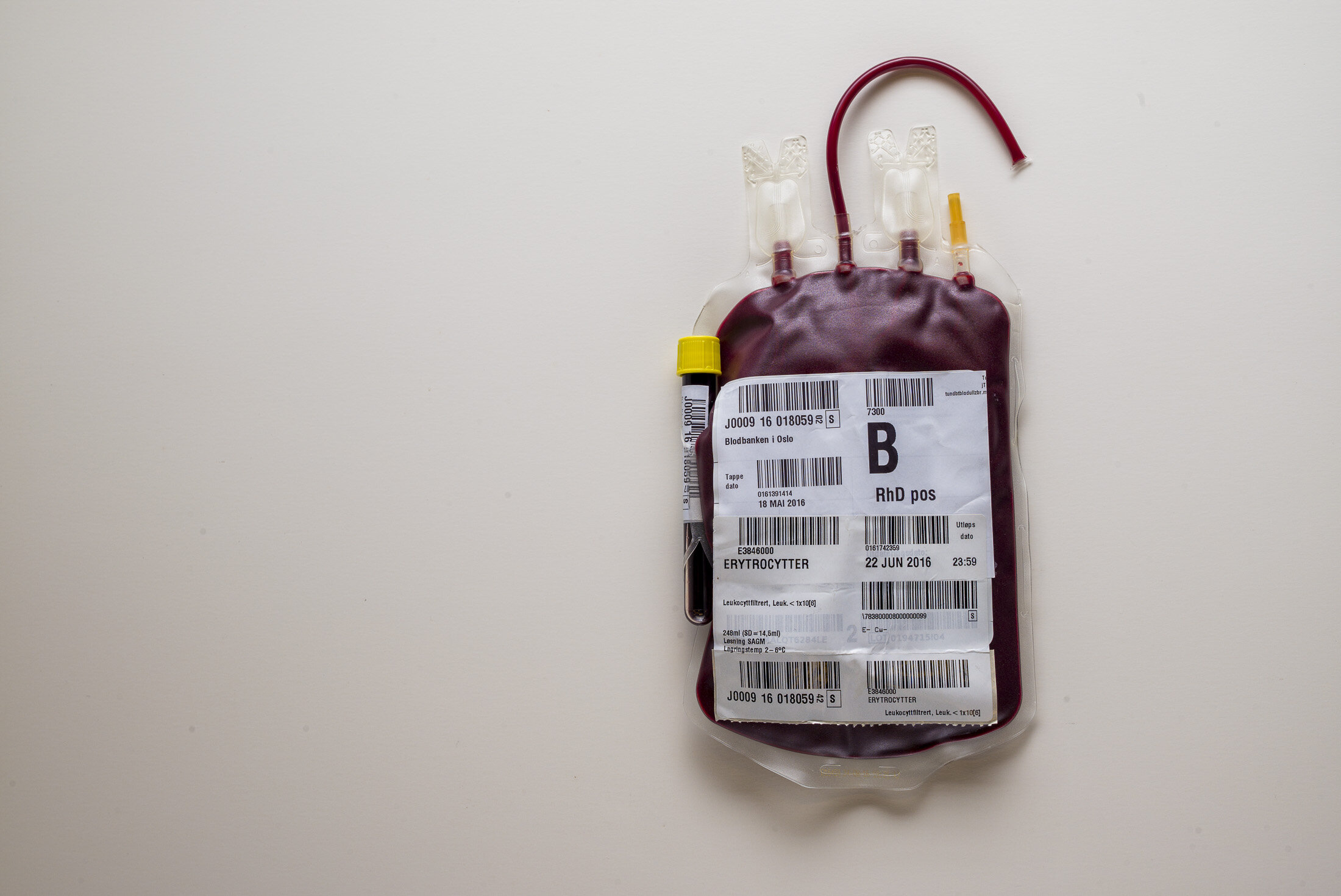 blodposer, blodgivning Bildet viser en blodpose.