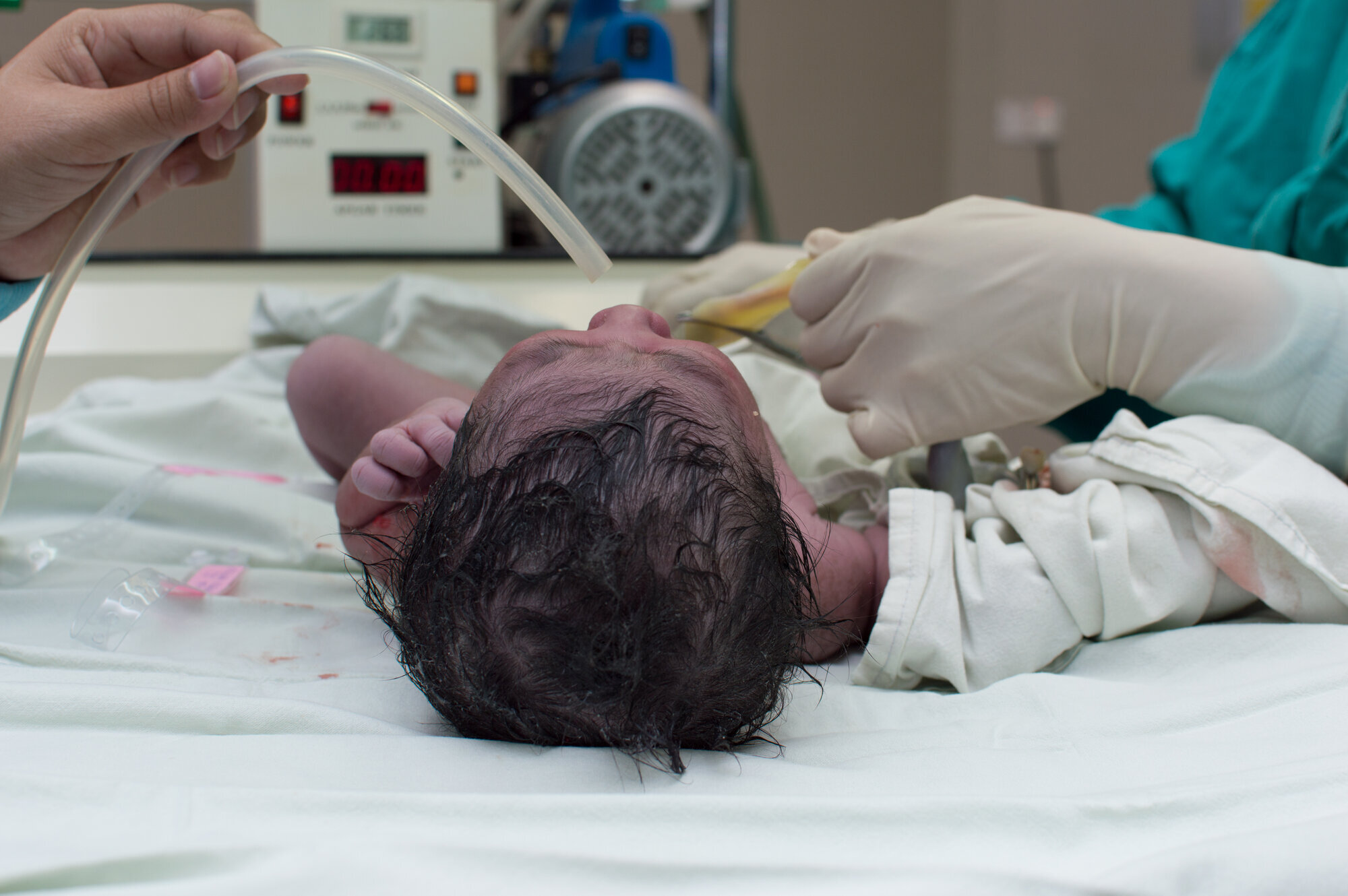 Bilde av en nyfødt prematur baby. Bilde av en nyfødt prematur baby.