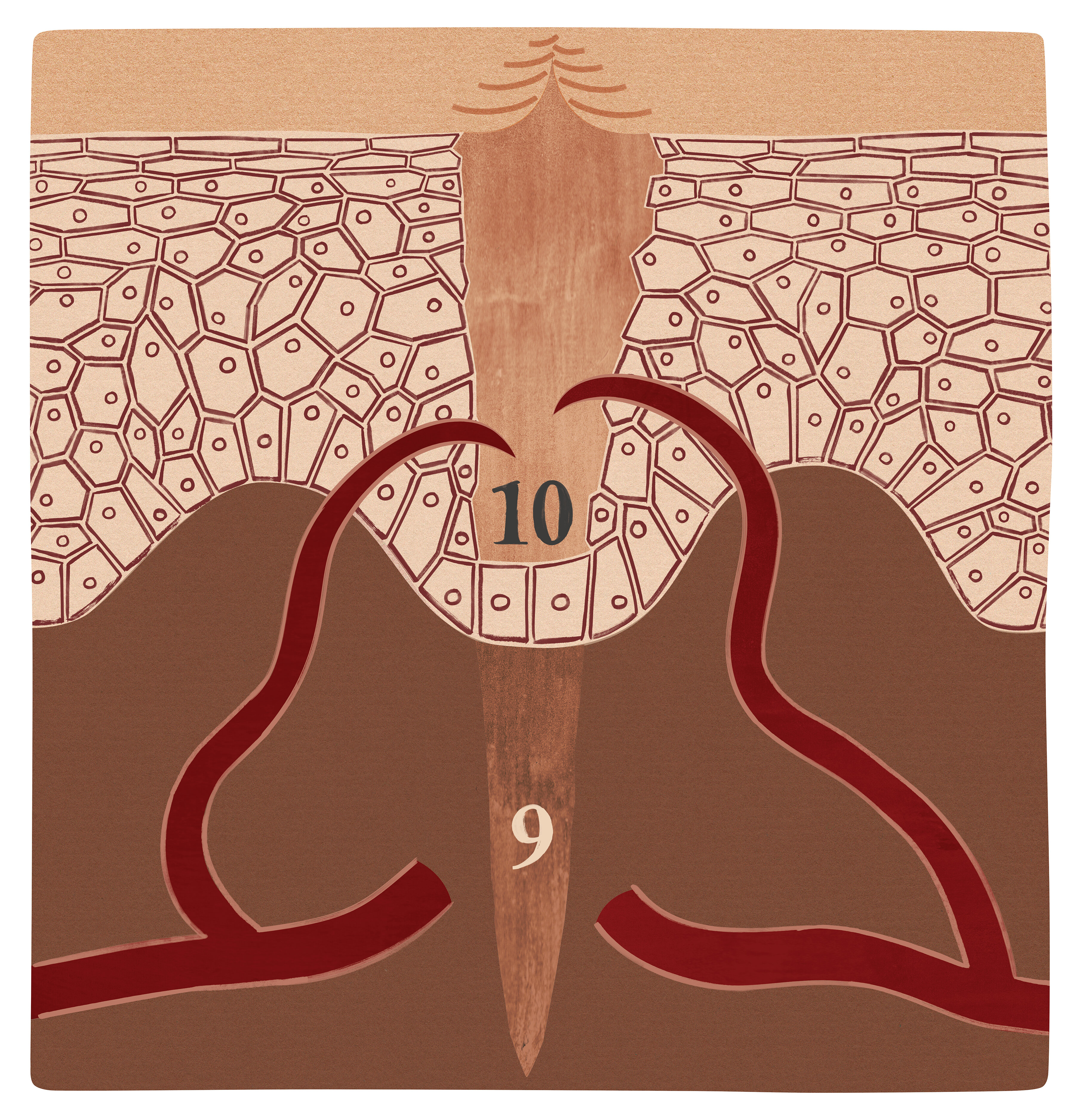 Sår i granulasjonsfasen Illustrasjonen viser et sår i granulasjonsfasen