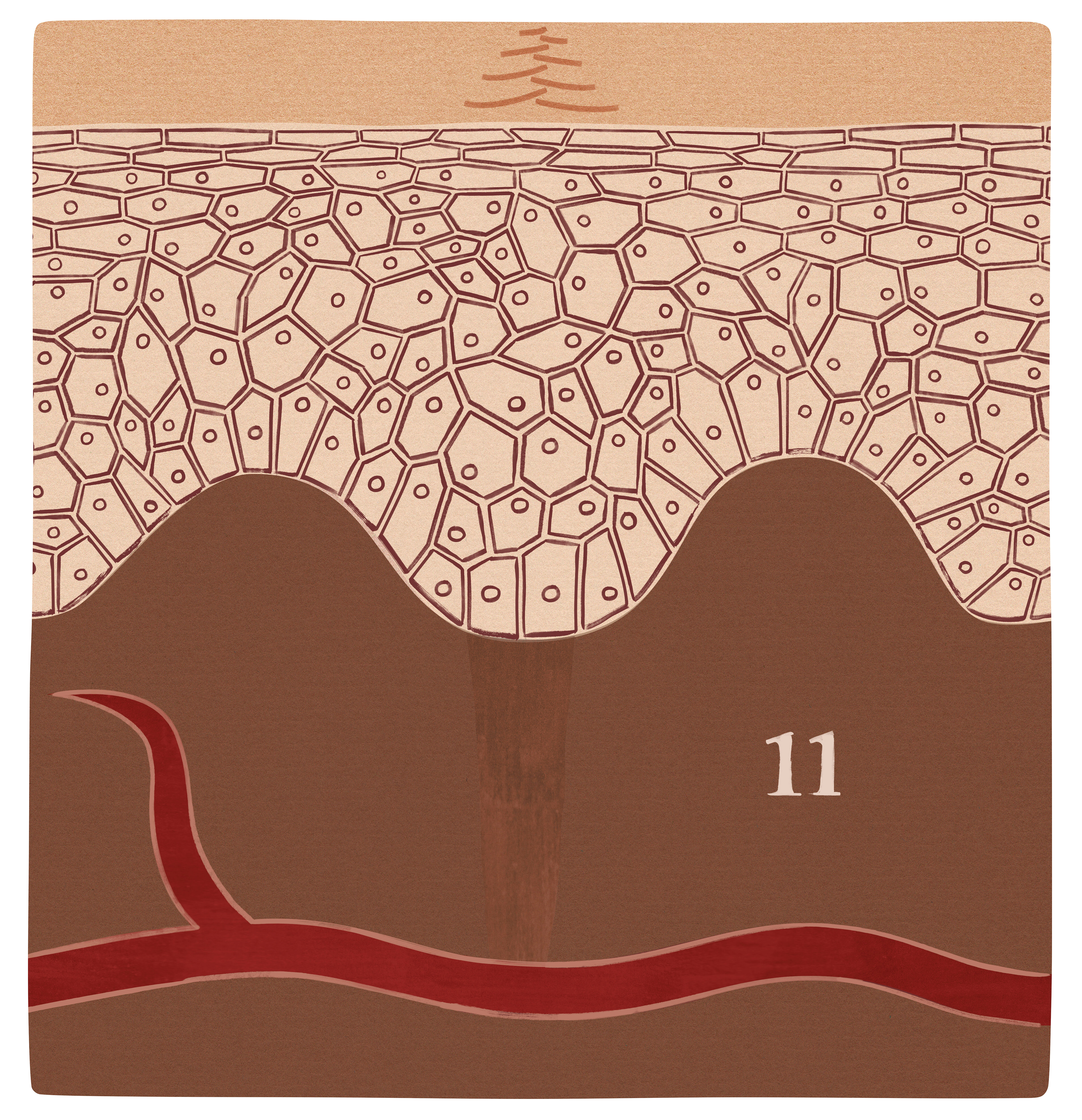 Sår i modningsfasen Illustrasjonen viser et sår i modningsfasen