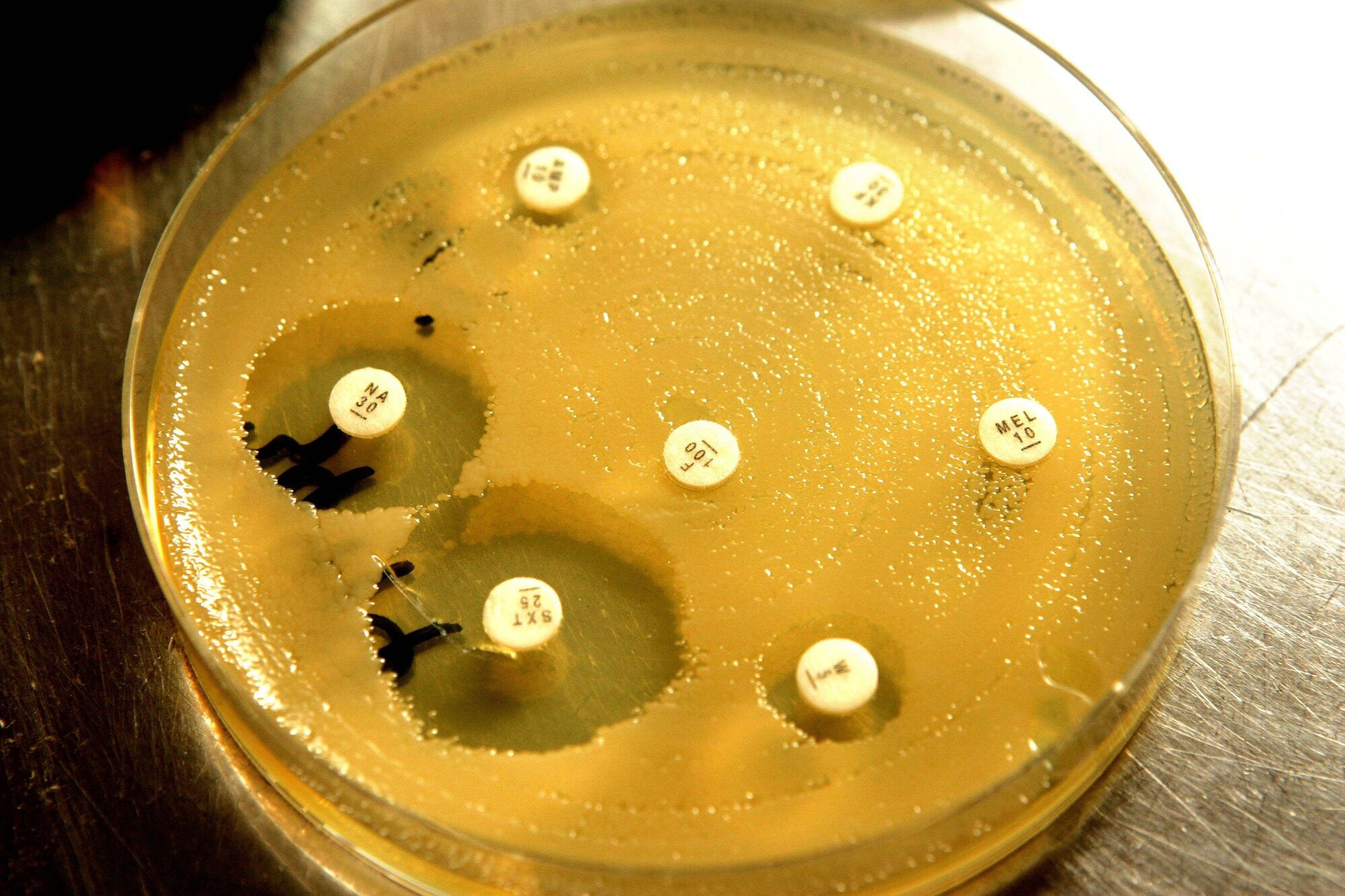 Resistens Bildet viser antibiotikaresistente bakterier i en petriskål