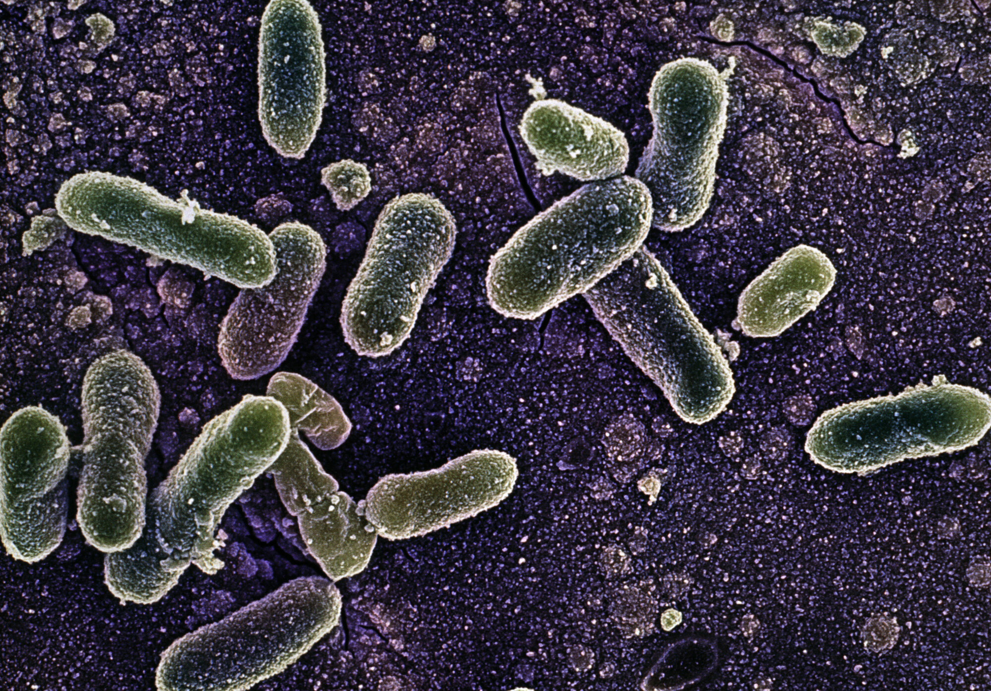 Salmonella enteritidis Bildet viser bakterier av typen salmonella enteritidis.