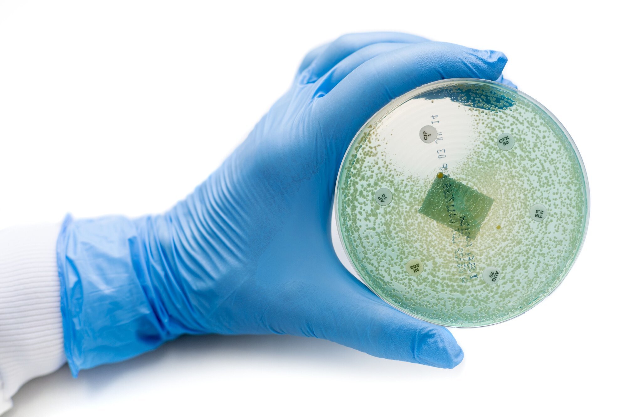 Antibiotikaresistens, forskning Bildet viser en hanskekledt hånd som holder en petriskål.
