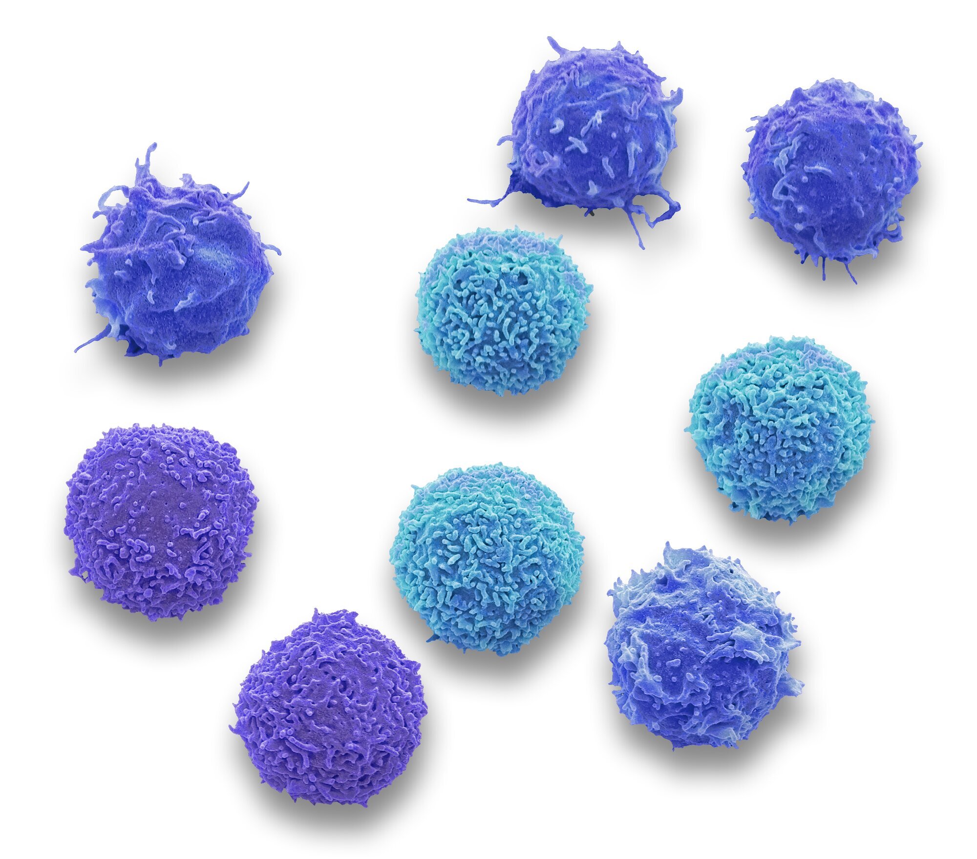 Leukocytter Bildet viser hvite blodlegemer.