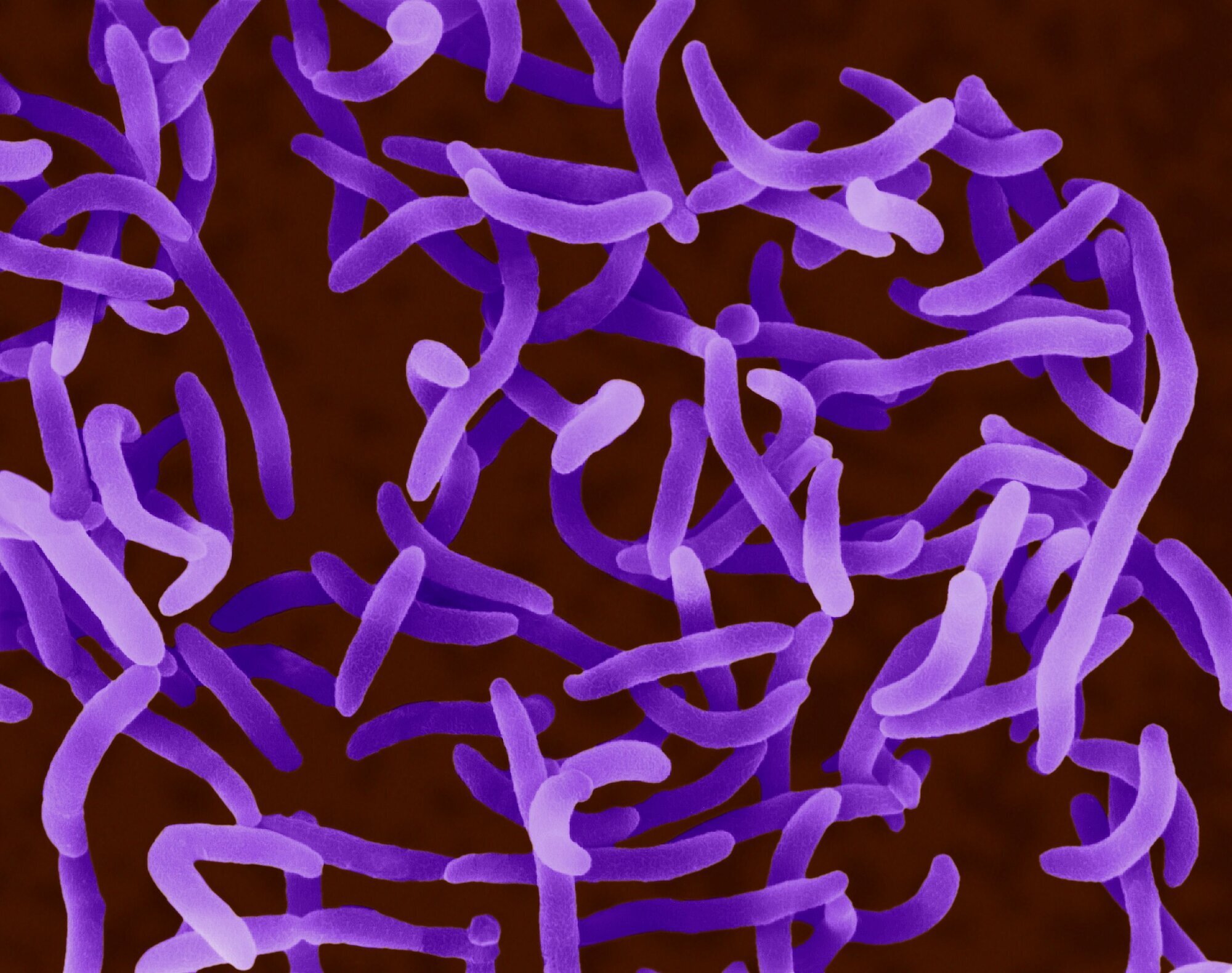 Vibrio cholerae Bildet viser vibriobakterien Vibrio cholerae