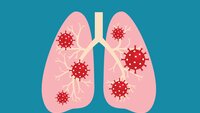 Illustrasjonen viser lunger med koronavirus.