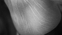 Seksualitet Bildet viser deler av en naken kropp med strekkmerker