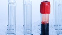 Blod, blodprøve Bildet viser et blodprøveglass fylt med blod.