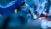 Bildet viser et operasjonsteam som bruker kikkhullskirurgi