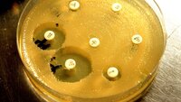 Resistens Bildet viser antibiotikaresistente bakterier i en petriskål